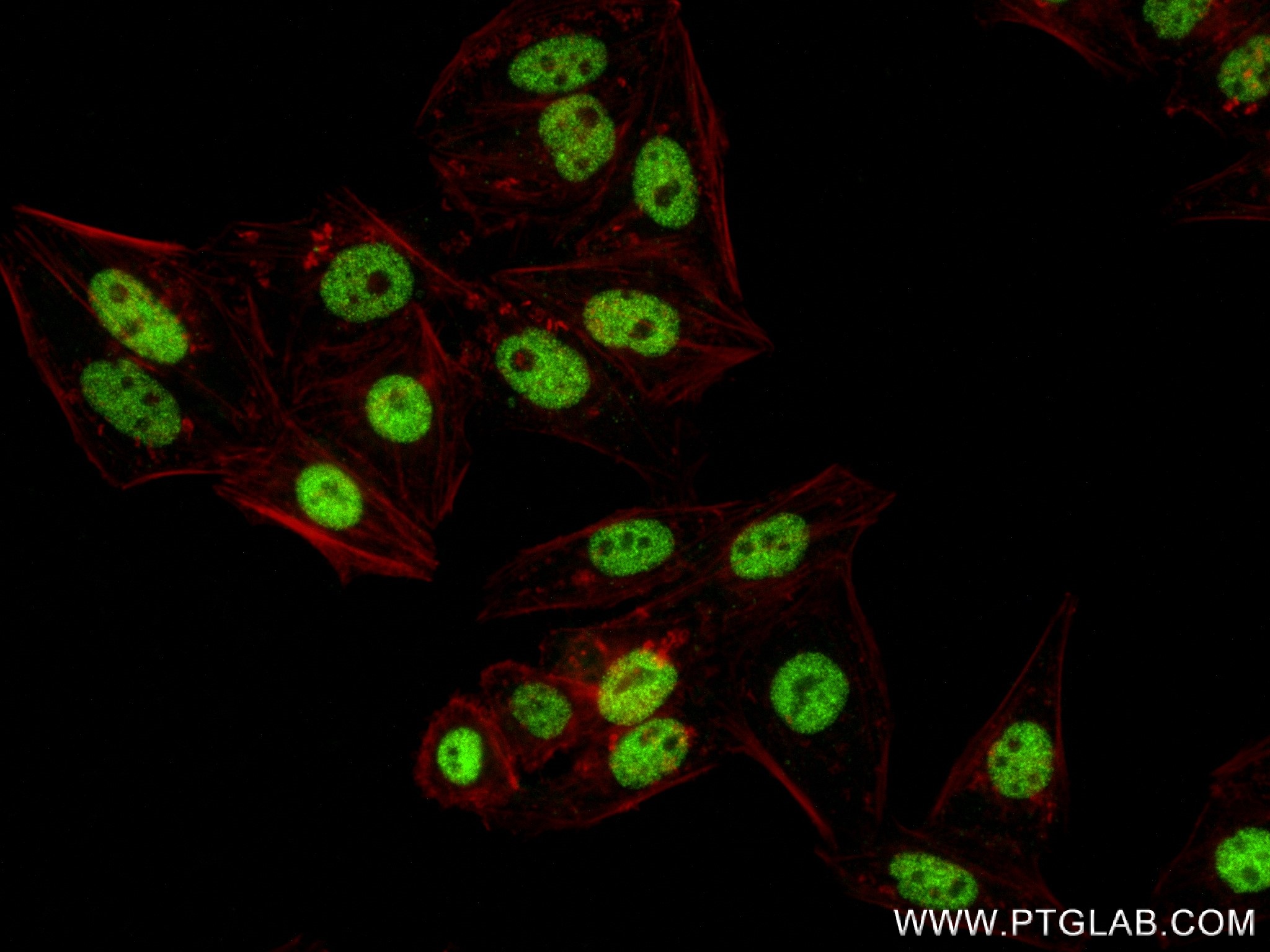 Immunofluorescence (IF) / fluorescent staining of HepG2 cells using HMGB2 Recombinant antibody (83482-5-RR)