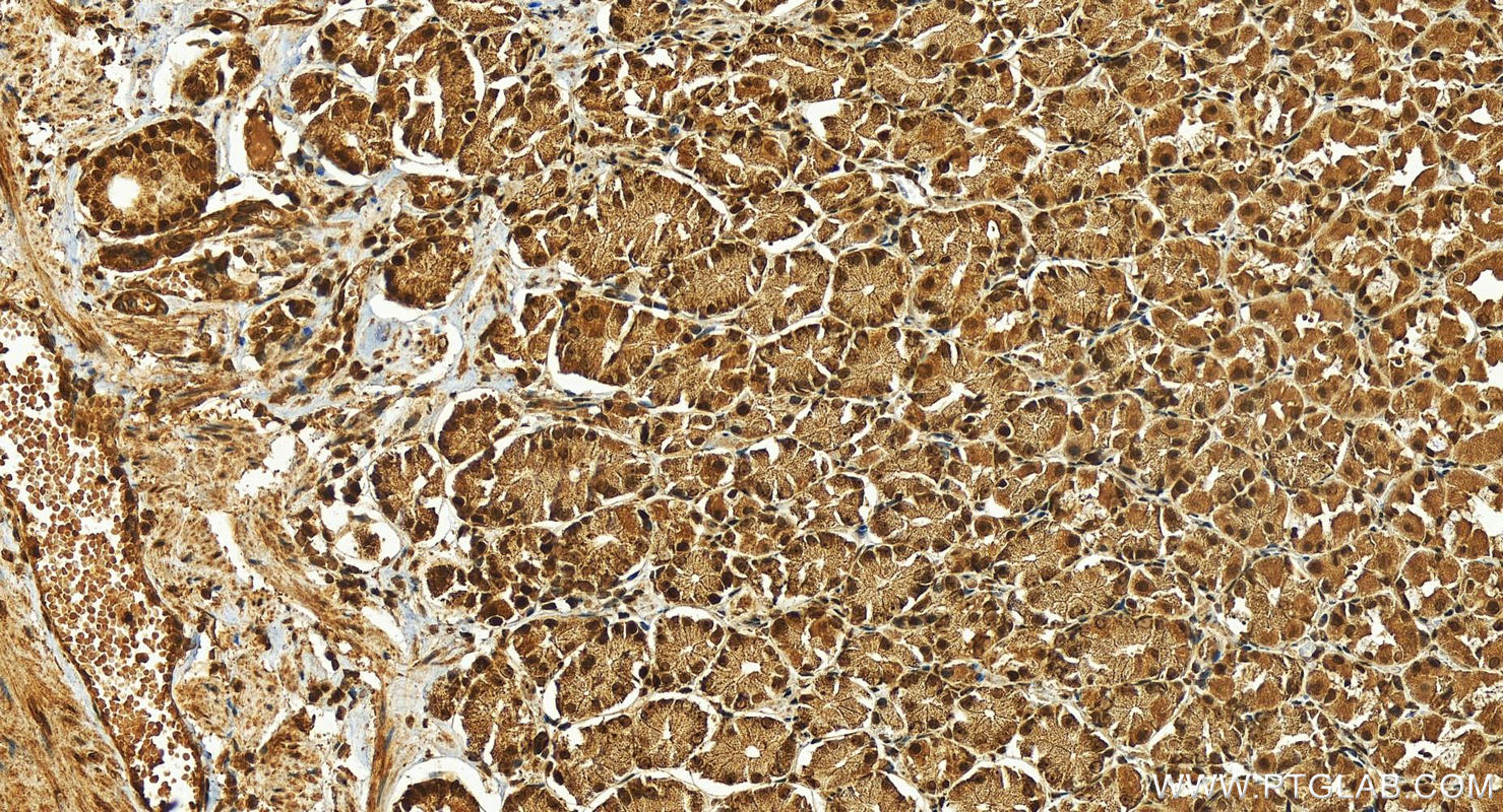 Immunohistochemistry (IHC) staining of human stomach tissue using HMGB3 Polyclonal antibody (27465-1-AP)