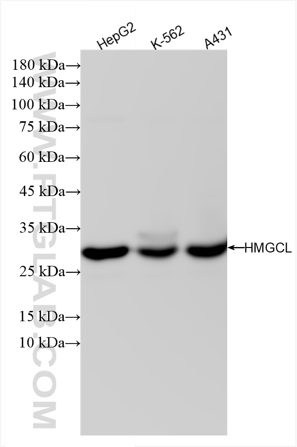 Western Blot (WB) analysis of various lysates using HMGCL Recombinant antibody (84769-1-RR)