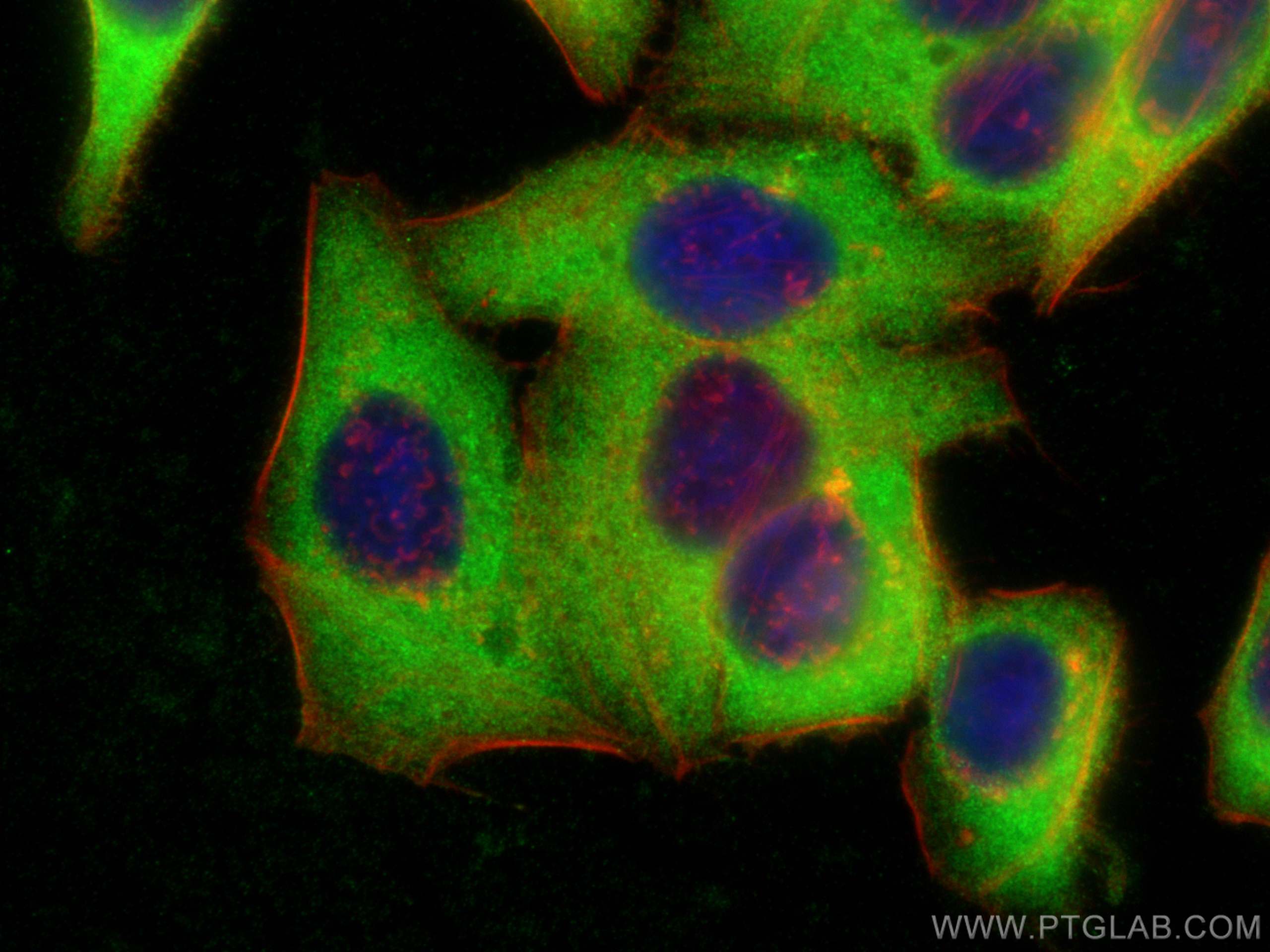 Immunofluorescence (IF) / fluorescent staining of HepG2 cells using HMGN1 Polyclonal antibody (11695-1-AP)