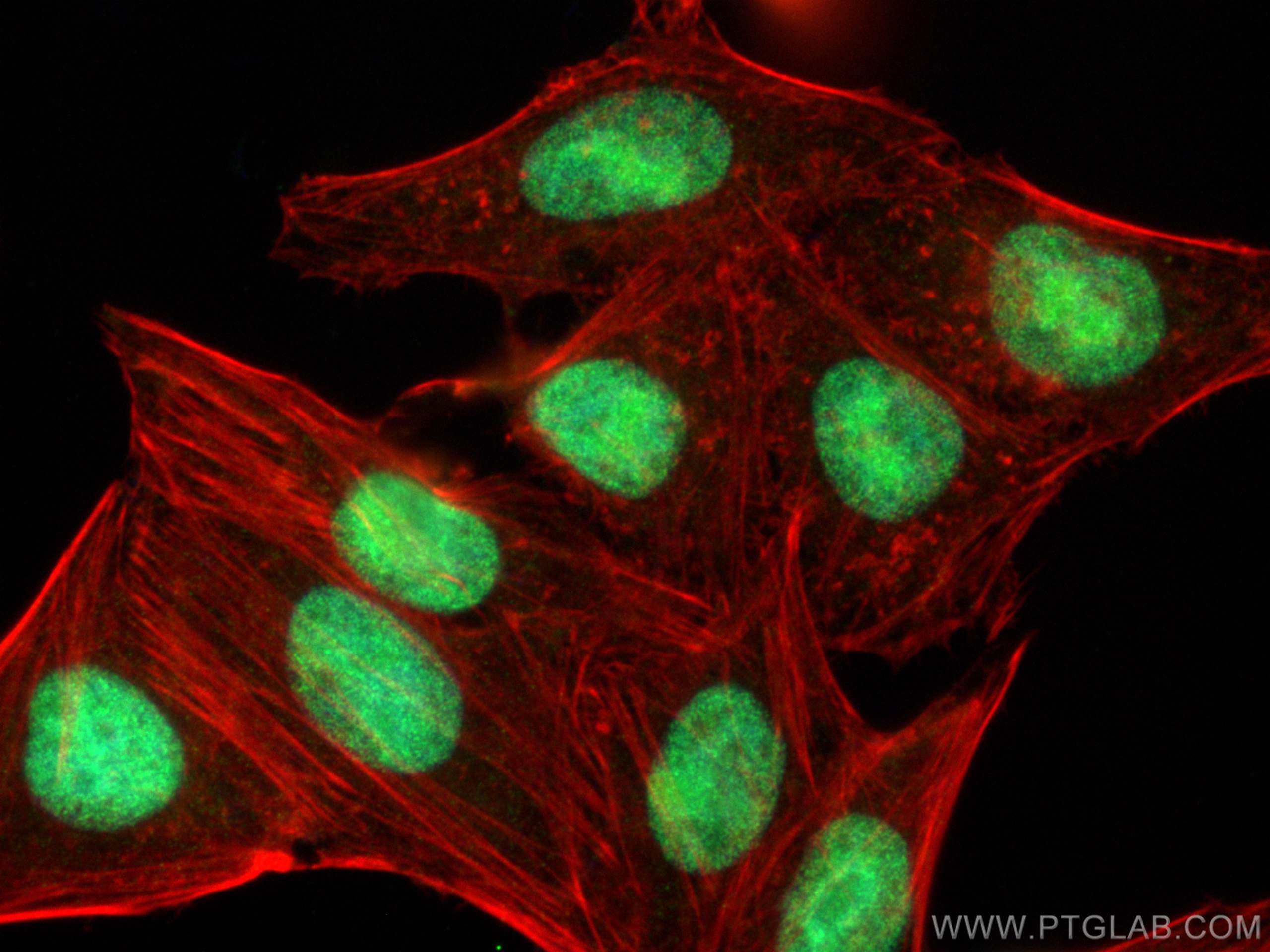 Immunofluorescence (IF) / fluorescent staining of HepG2 cells using HMGN2 Polyclonal antibody (10953-1-AP)