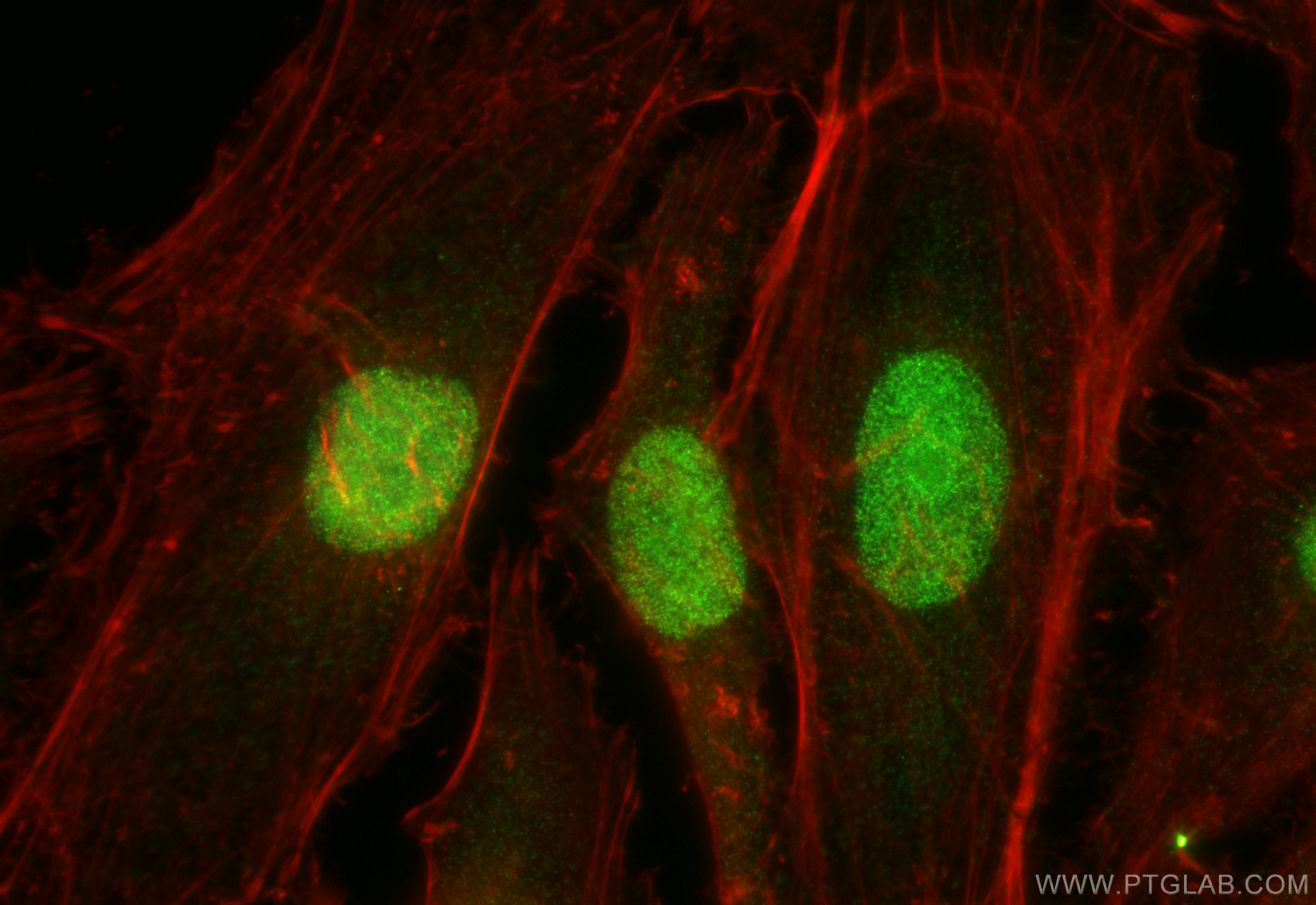 Immunofluorescence (IF) / fluorescent staining of HeLa cells using HMGN4 Polyclonal antibody (11686-1-AP)