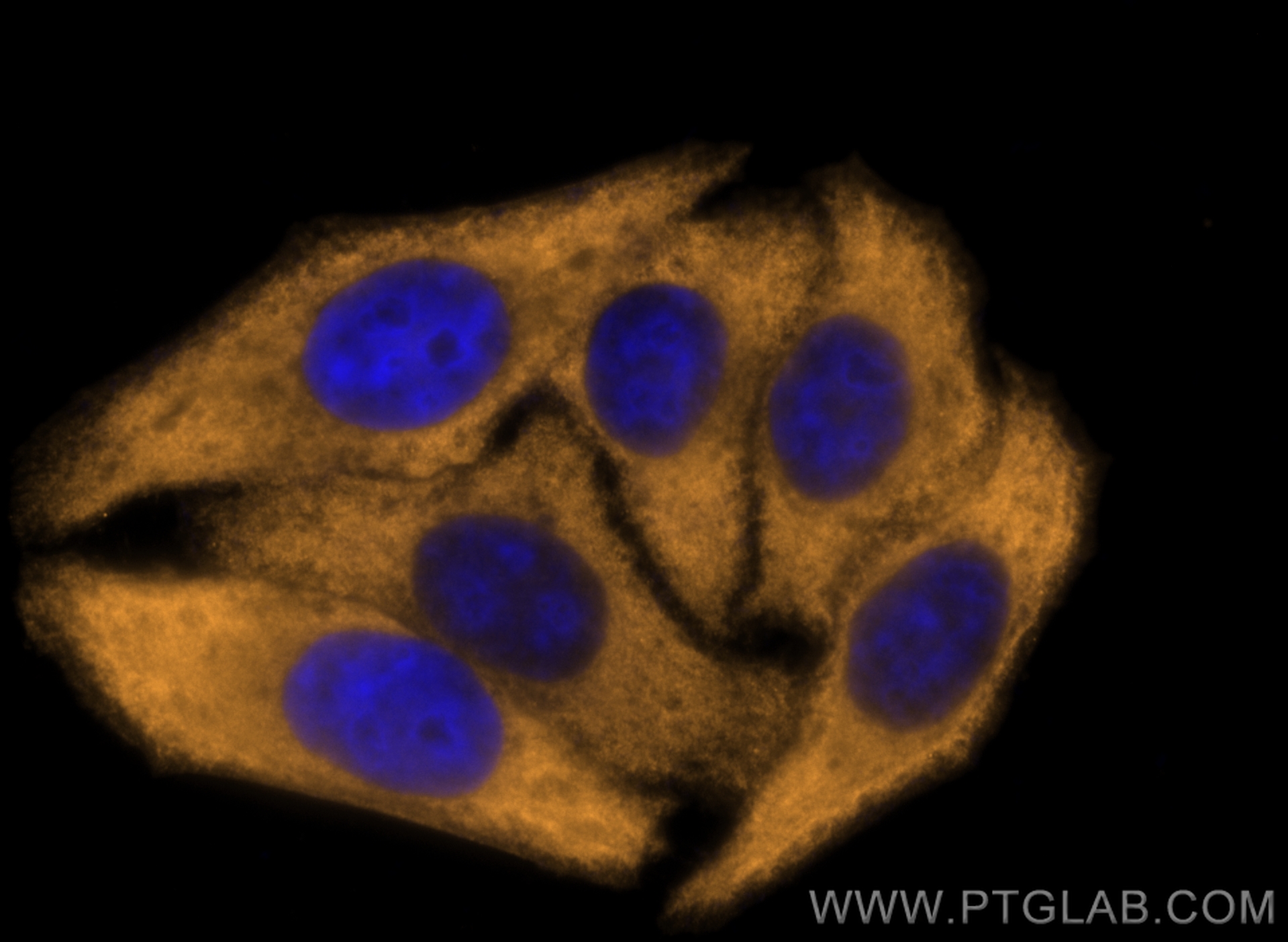 Immunofluorescence (IF) / fluorescent staining of HepG2 cells using CoraLite®555-conjugated HMMR-Specific Polyclonal a (CL555-15820)