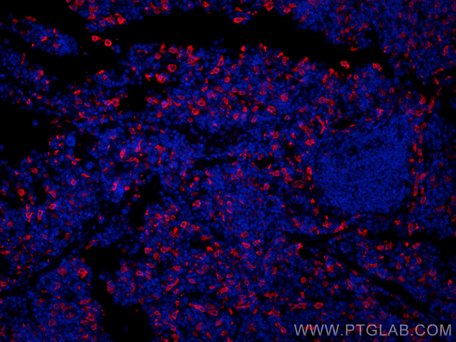 Immunofluorescence (IF) / fluorescent staining of mouse spleen tissue using HO-1/HMOX1 Polyclonal antibody (10701-1-AP)