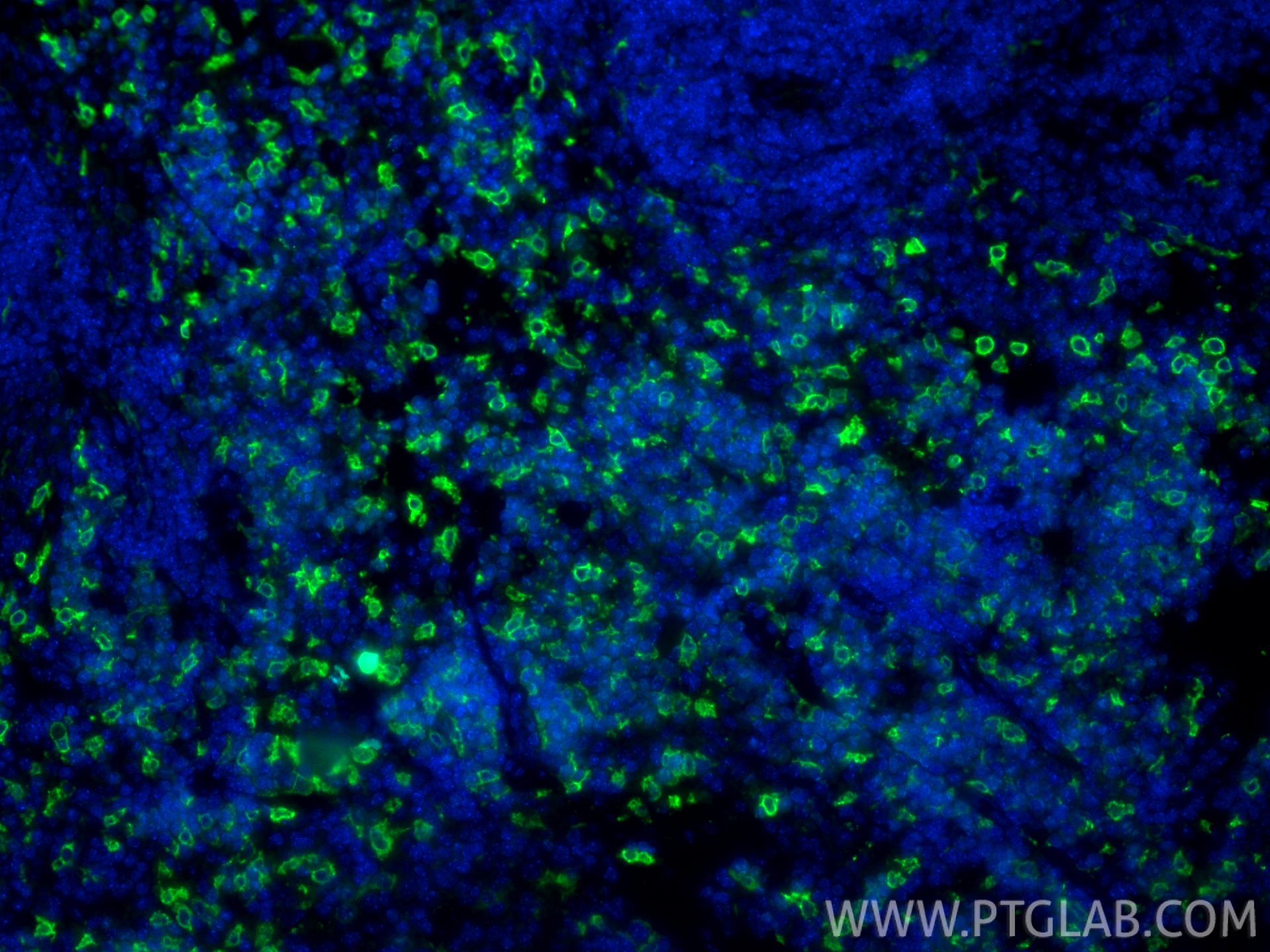 Immunofluorescence (IF) / fluorescent staining of mouse spleen tissue using HO-1/HMOX1 Polyclonal antibody (10701-1-AP)