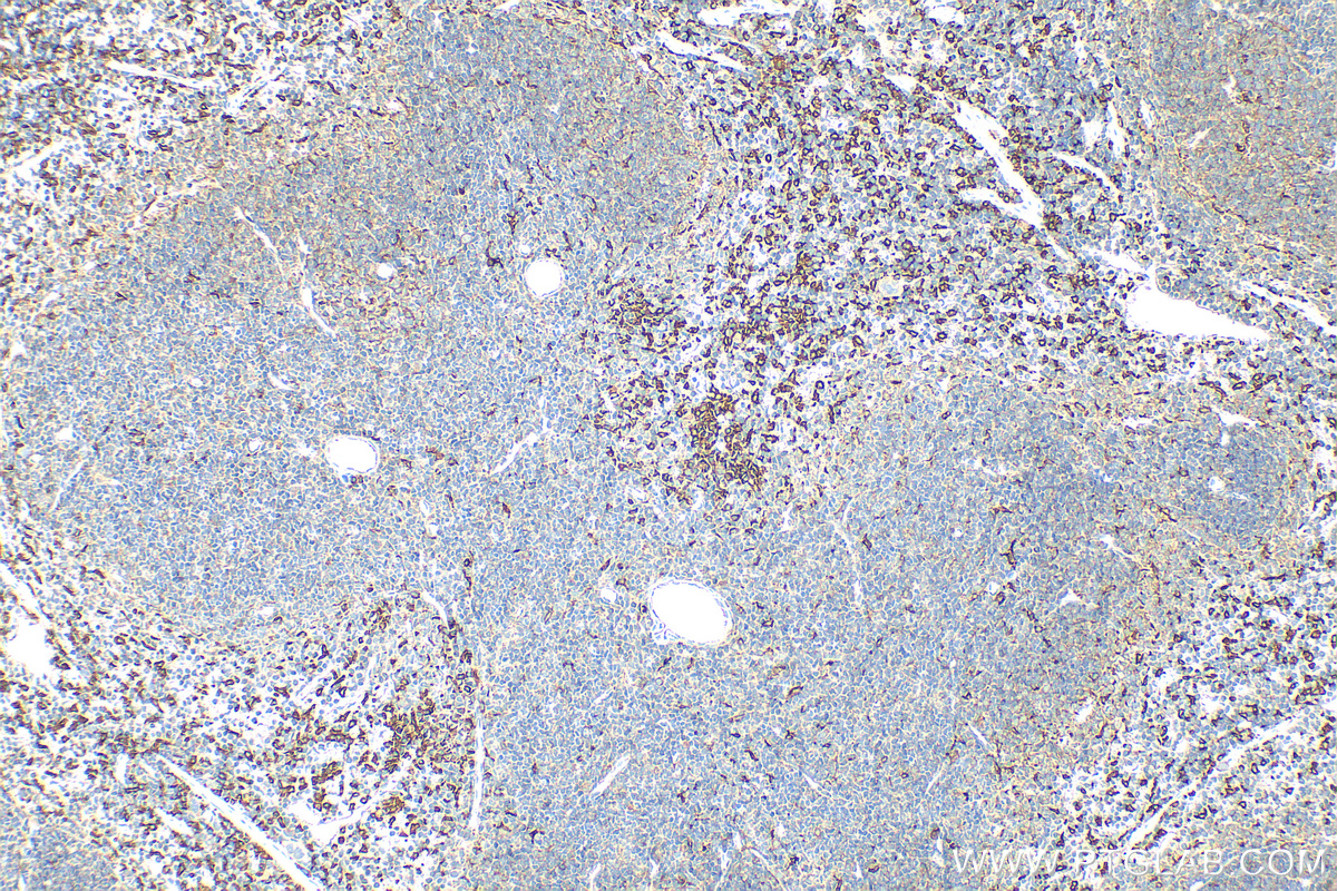 Immunohistochemistry (IHC) staining of mouse spleen tissue using HO-1/HMOX1 Polyclonal antibody (10701-1-AP)