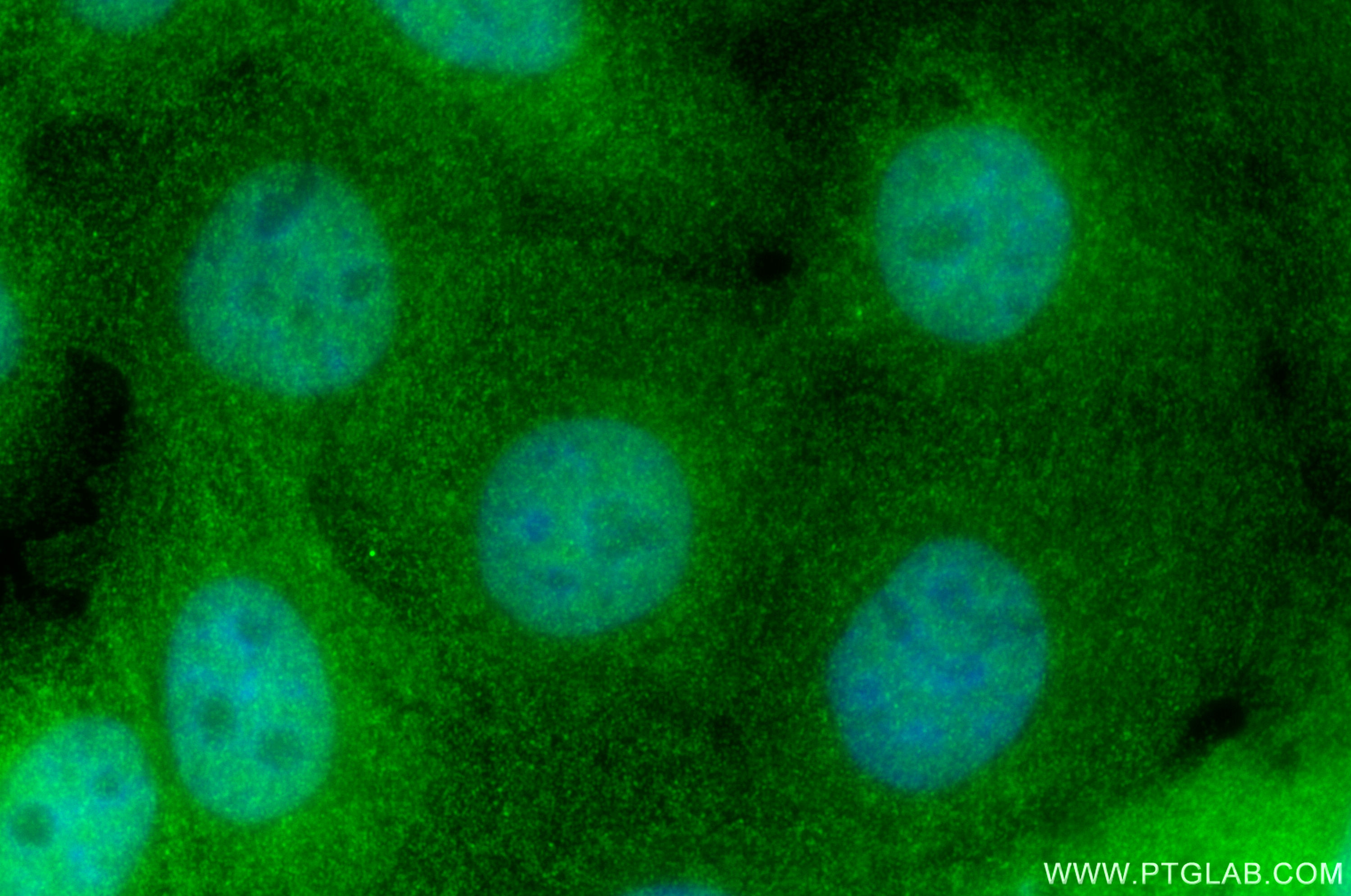 Immunofluorescence (IF) / fluorescent staining of A431 cells using HN1L Polyclonal antibody (16285-1-AP)