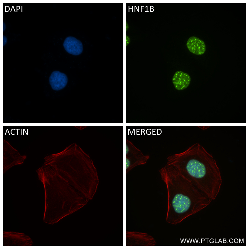 Immunofluorescence (IF) / fluorescent staining of HepG2 cells using HNF1B Recombinant antibody (84684-5-RR)