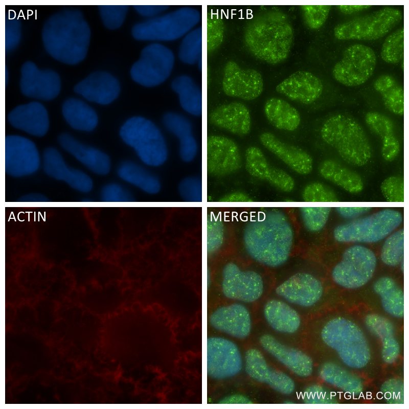 Immunofluorescence (IF) / fluorescent staining of Caco-2 cells using HNF1B Recombinant antibody (84684-5-RR)