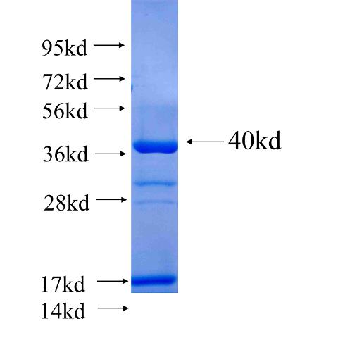 HNF1B fusion protein Ag24226 SDS-PAGE