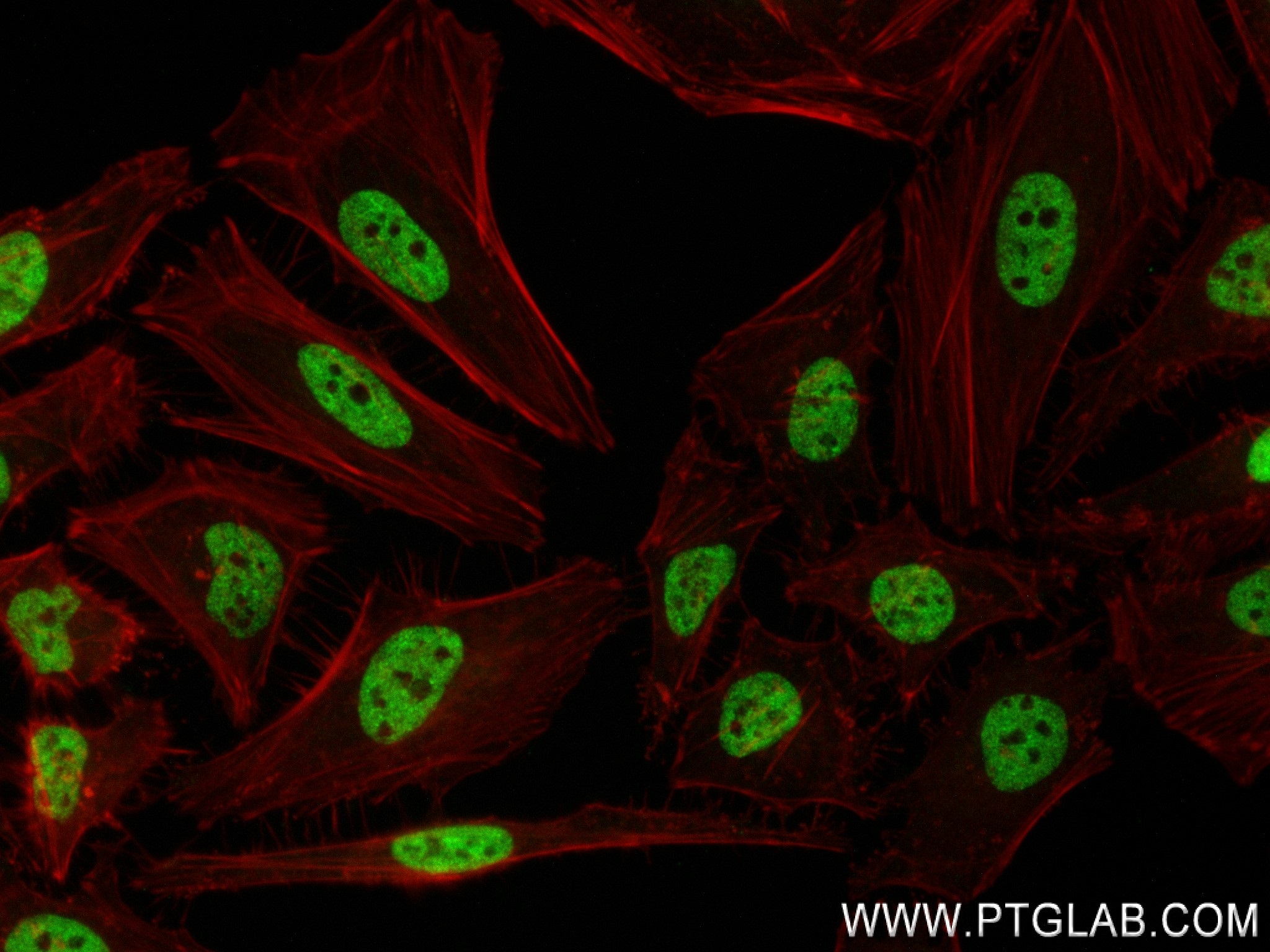 Immunofluorescence (IF) / fluorescent staining of HeLa cells using HNF4A Recombinant antibody (84316-7-RR)