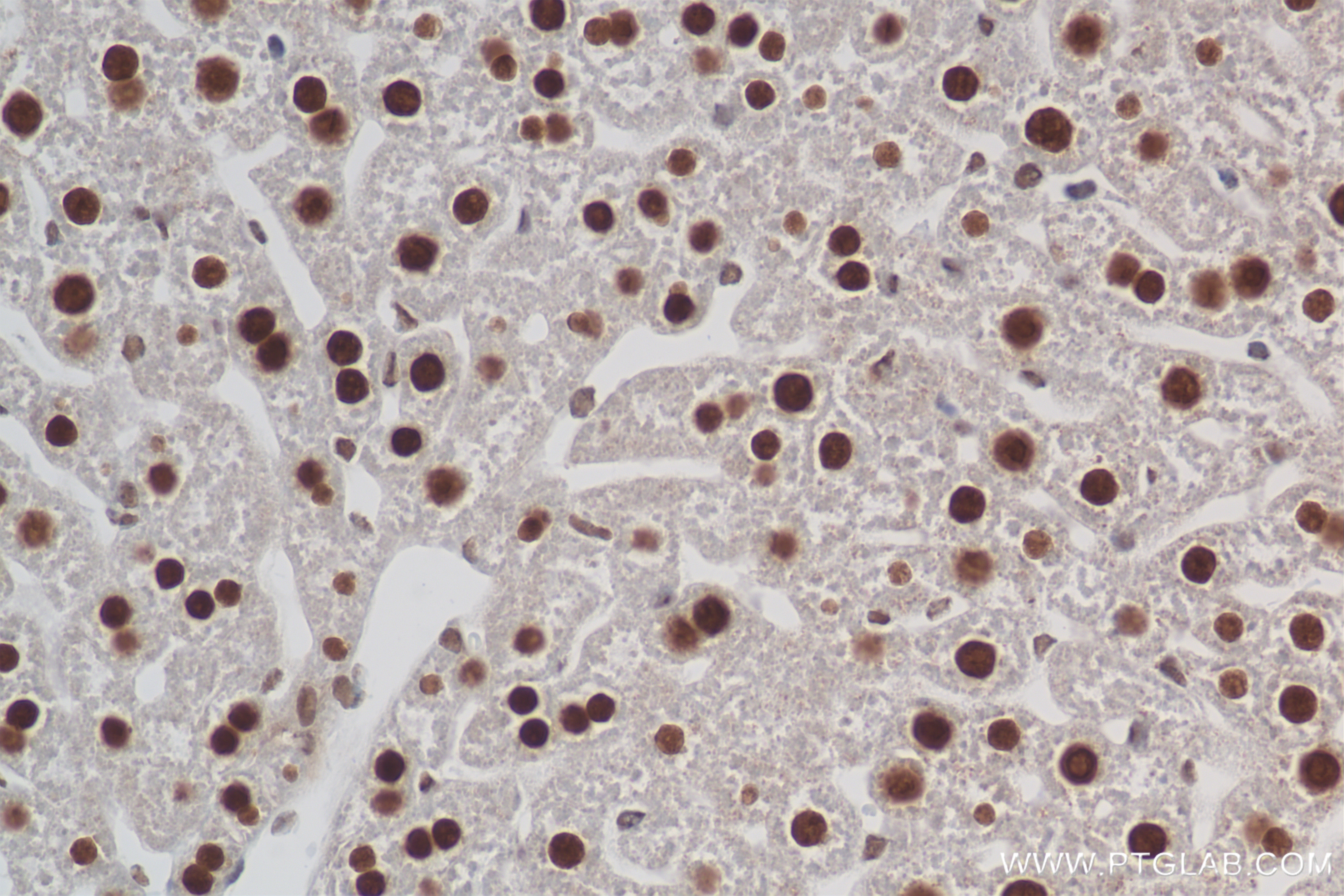 Immunohistochemistry (IHC) staining of mouse liver tissue using HNF4A Recombinant antibody (84316-7-RR)