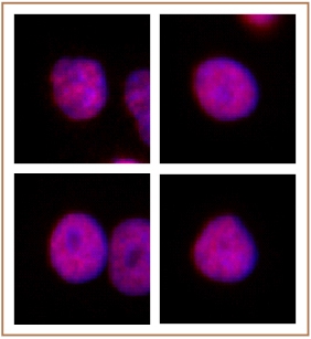 HNF4A antibody (pAb) tested by Immunofluorescence. Formaldehyde fixed HeLa cells stained with HNF4A antibody at a 1:2,000 dilution.