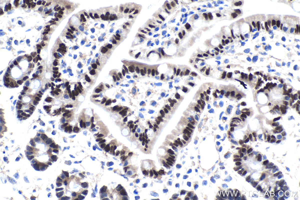 Immunohistochemistry (IHC) staining of mouse small intestine tissue using HNF4G Polyclonal antibody (25801-1-AP)