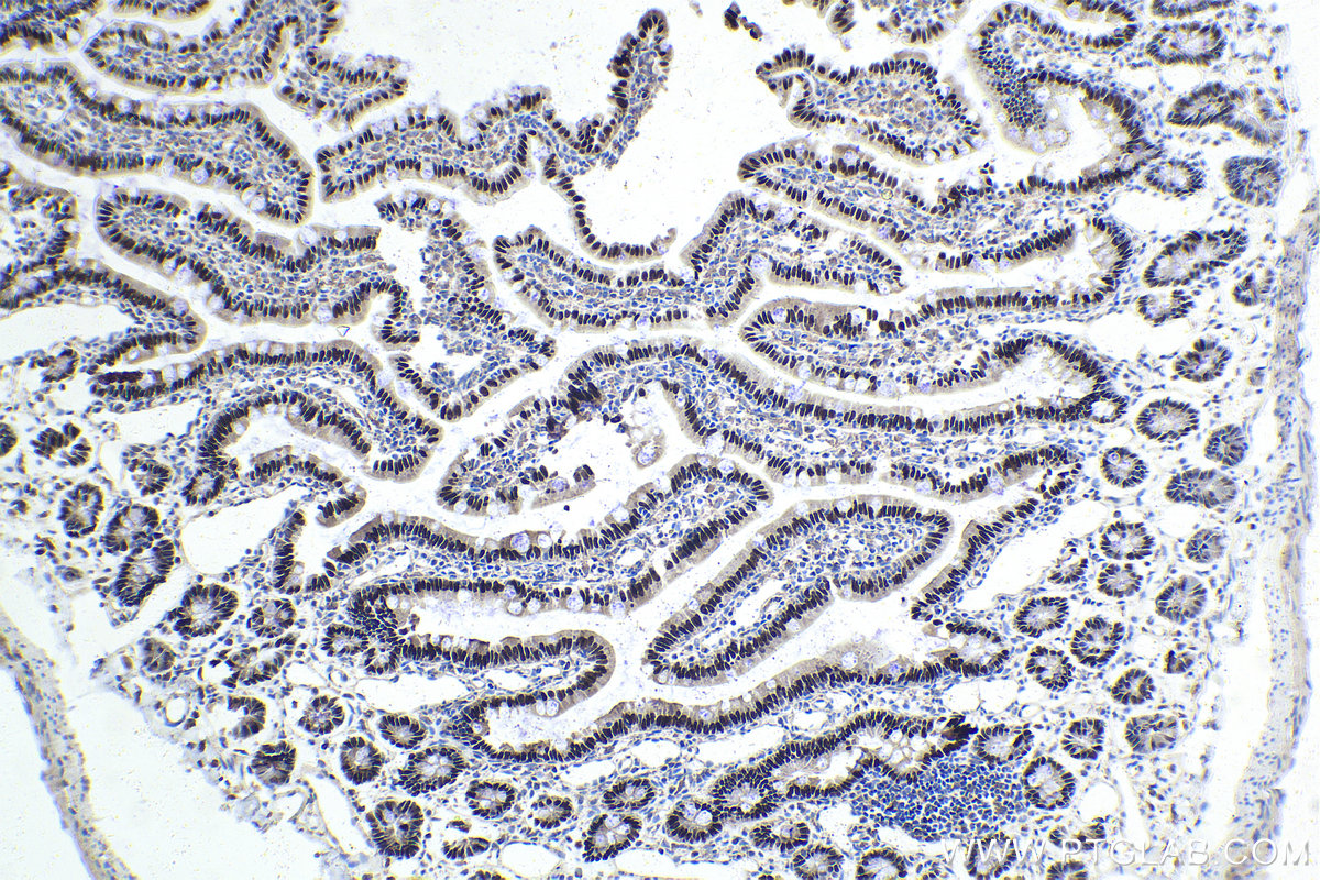 Immunohistochemistry (IHC) staining of rat small intestine tissue using HNF4G Polyclonal antibody (25801-1-AP)