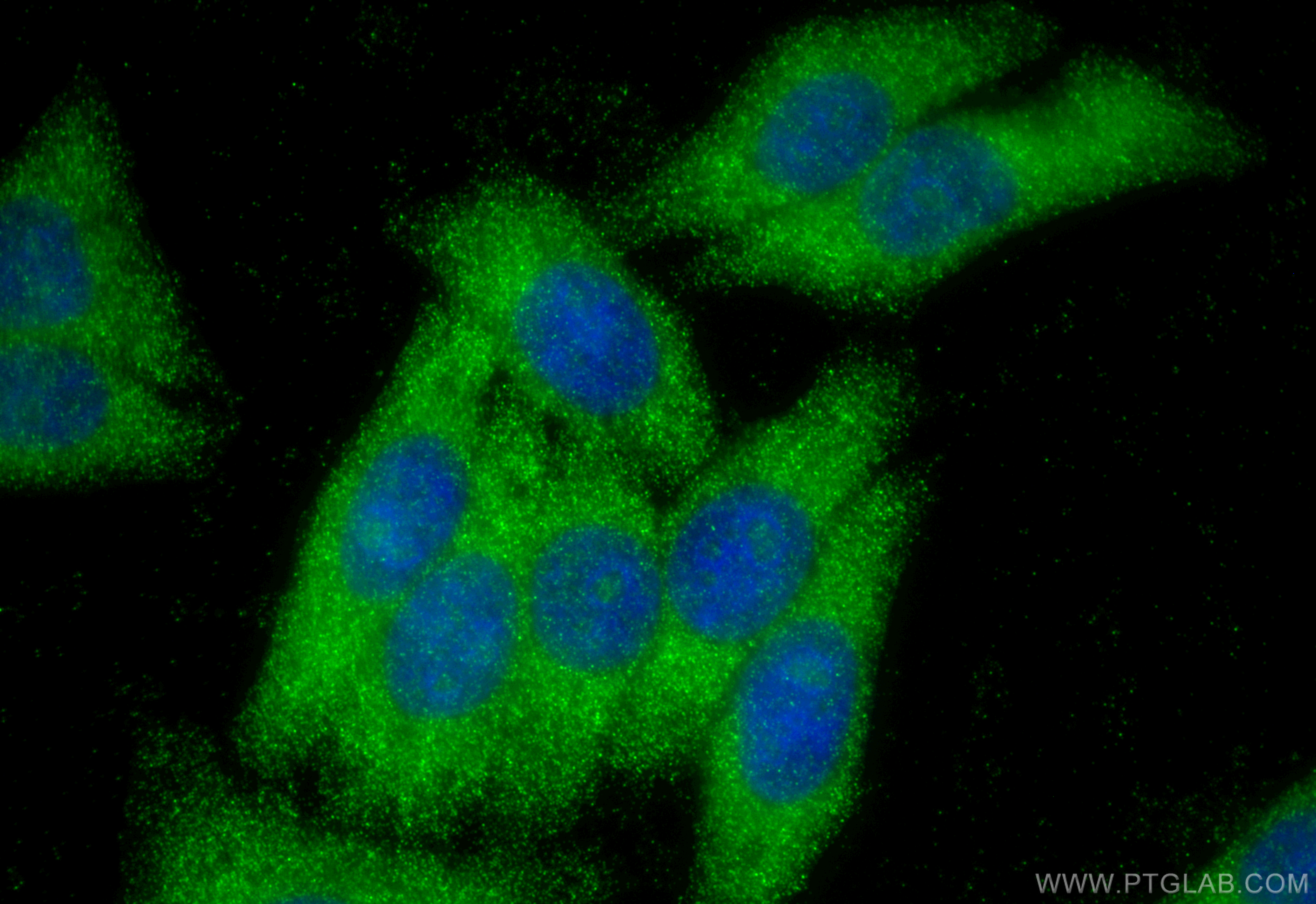 Immunofluorescence (IF) / fluorescent staining of HepG2 cells using HNMT Polyclonal antibody (11874-1-AP)