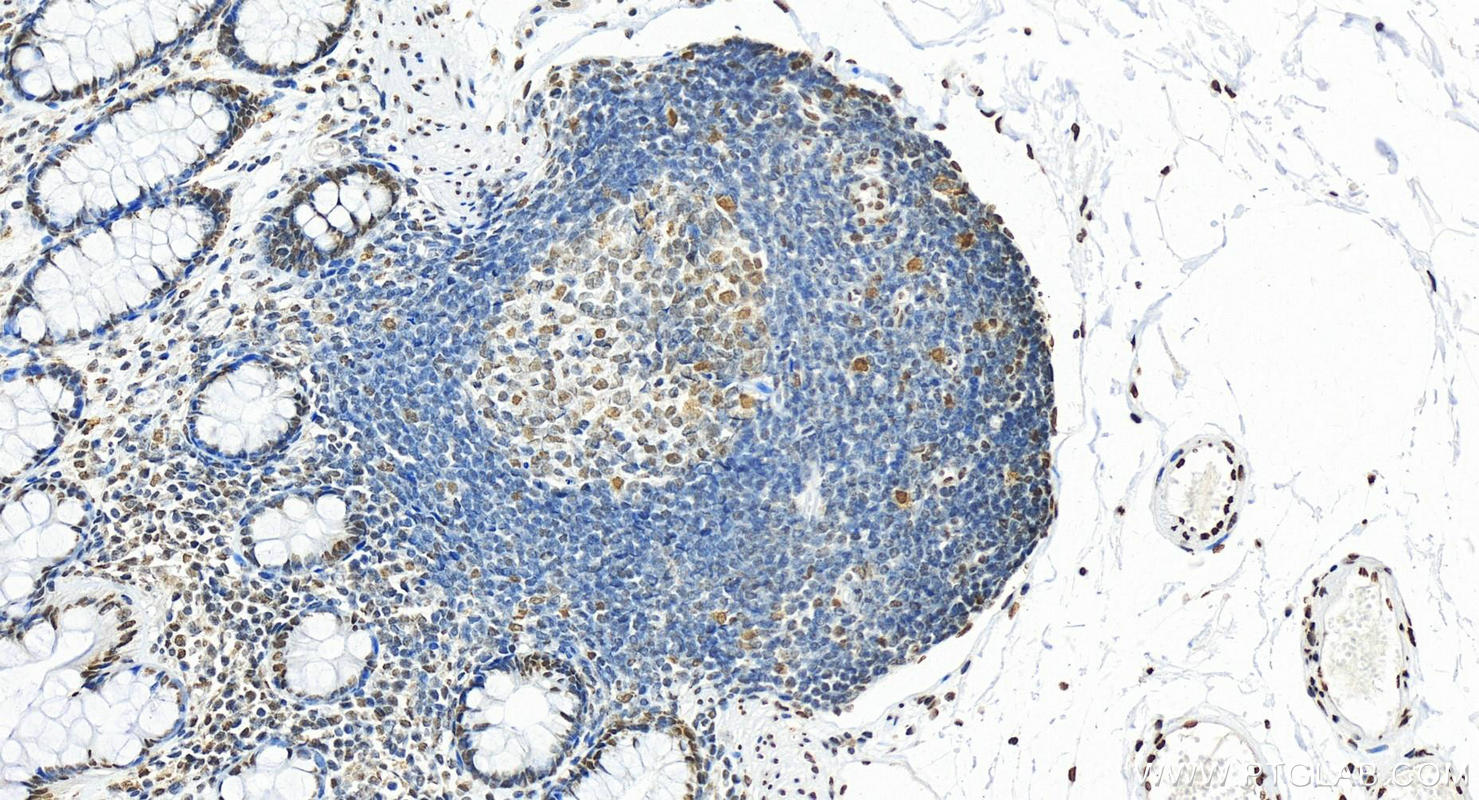 Immunohistochemistry (IHC) staining of human colon tissue using HNRNPA1 Polyclonal antibody (11176-1-AP)