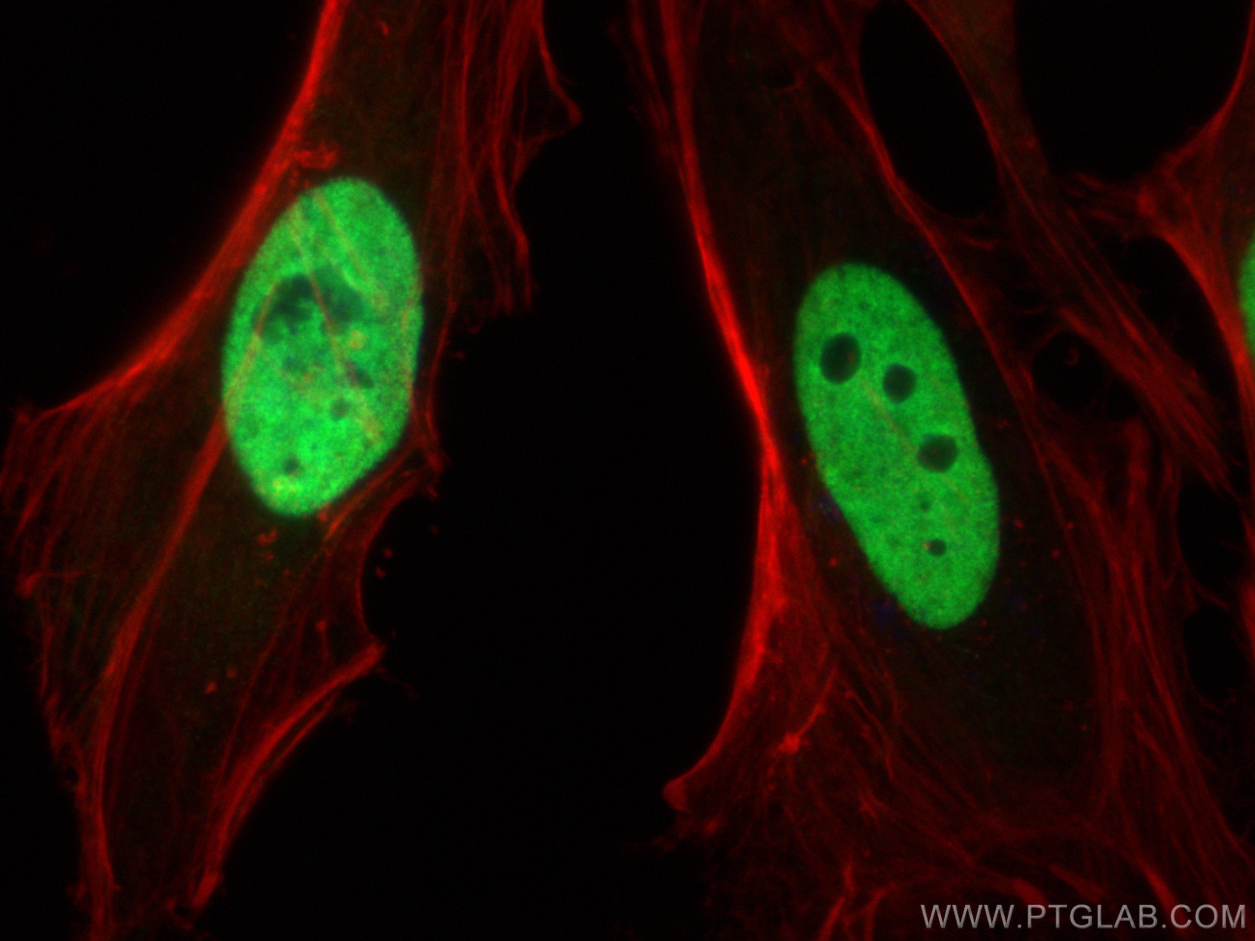 Immunofluorescence (IF) / fluorescent staining of HeLa cells using HNRNPA1 Polyclonal antibody (11176-1-AP)