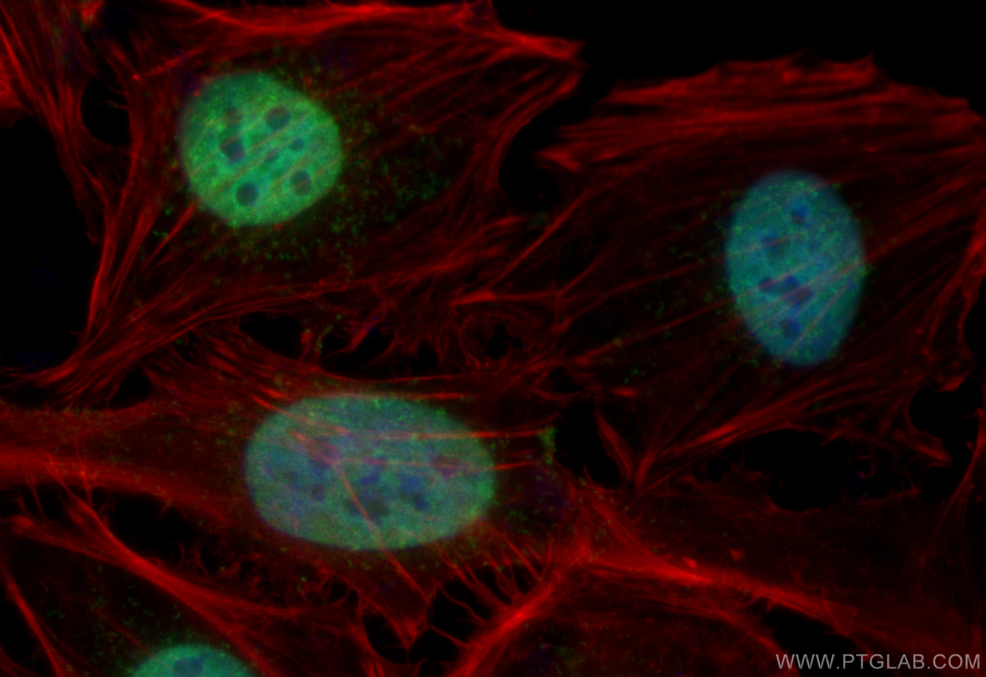 Immunofluorescence (IF) / fluorescent staining of HeLa cells using HNRNPA1 Monoclonal antibody (67844-1-Ig)