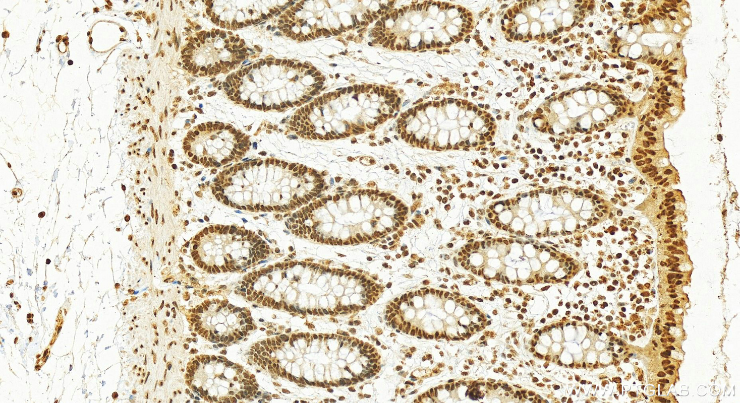 Immunohistochemistry (IHC) staining of human colon tissue using HNRNPA2B1 Polyclonal antibody (14813-1-AP)