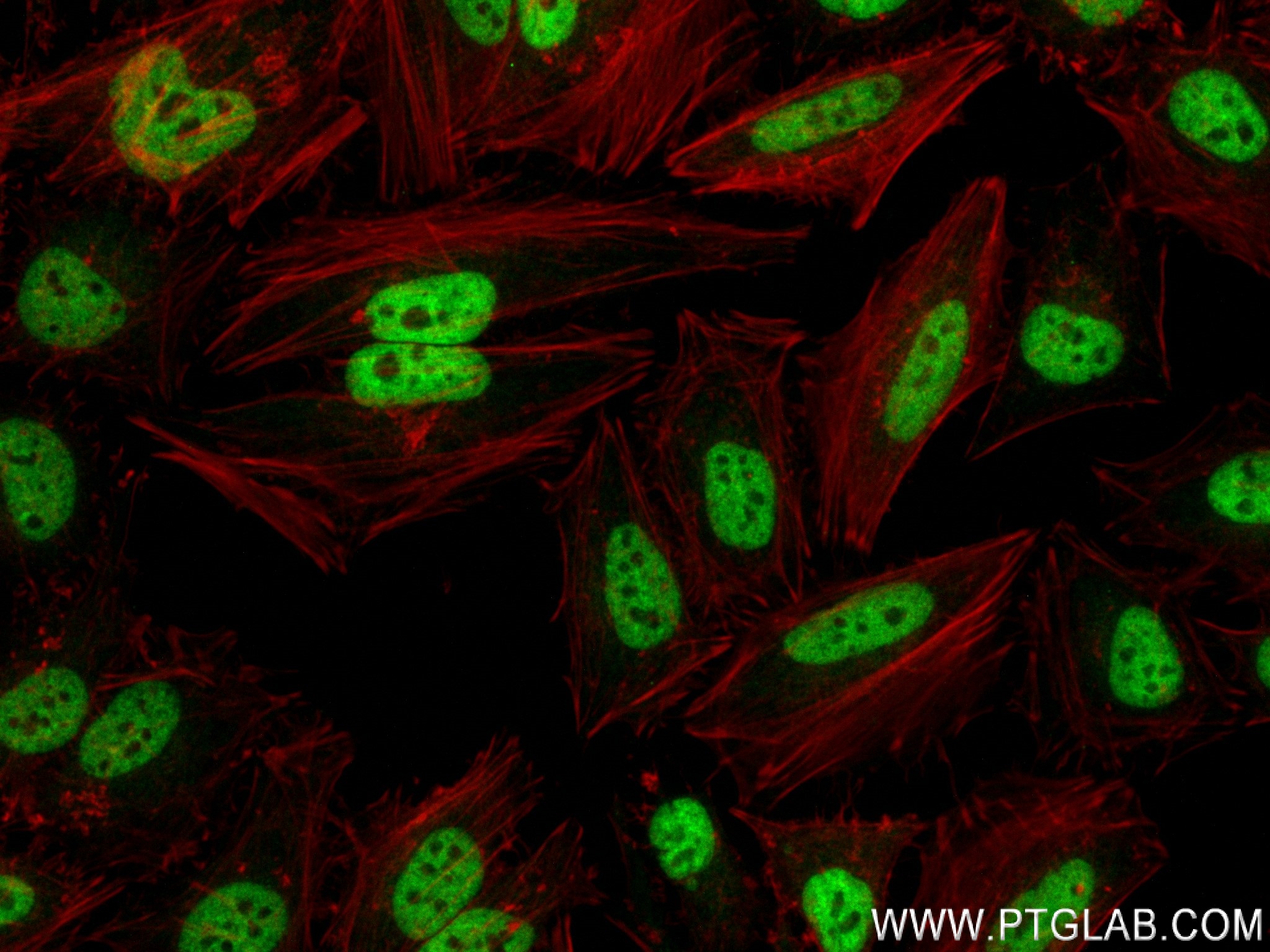 Immunofluorescence (IF) / fluorescent staining of HeLa cells using HNRNPA2B1 Recombinant antibody (83773-7-RR)