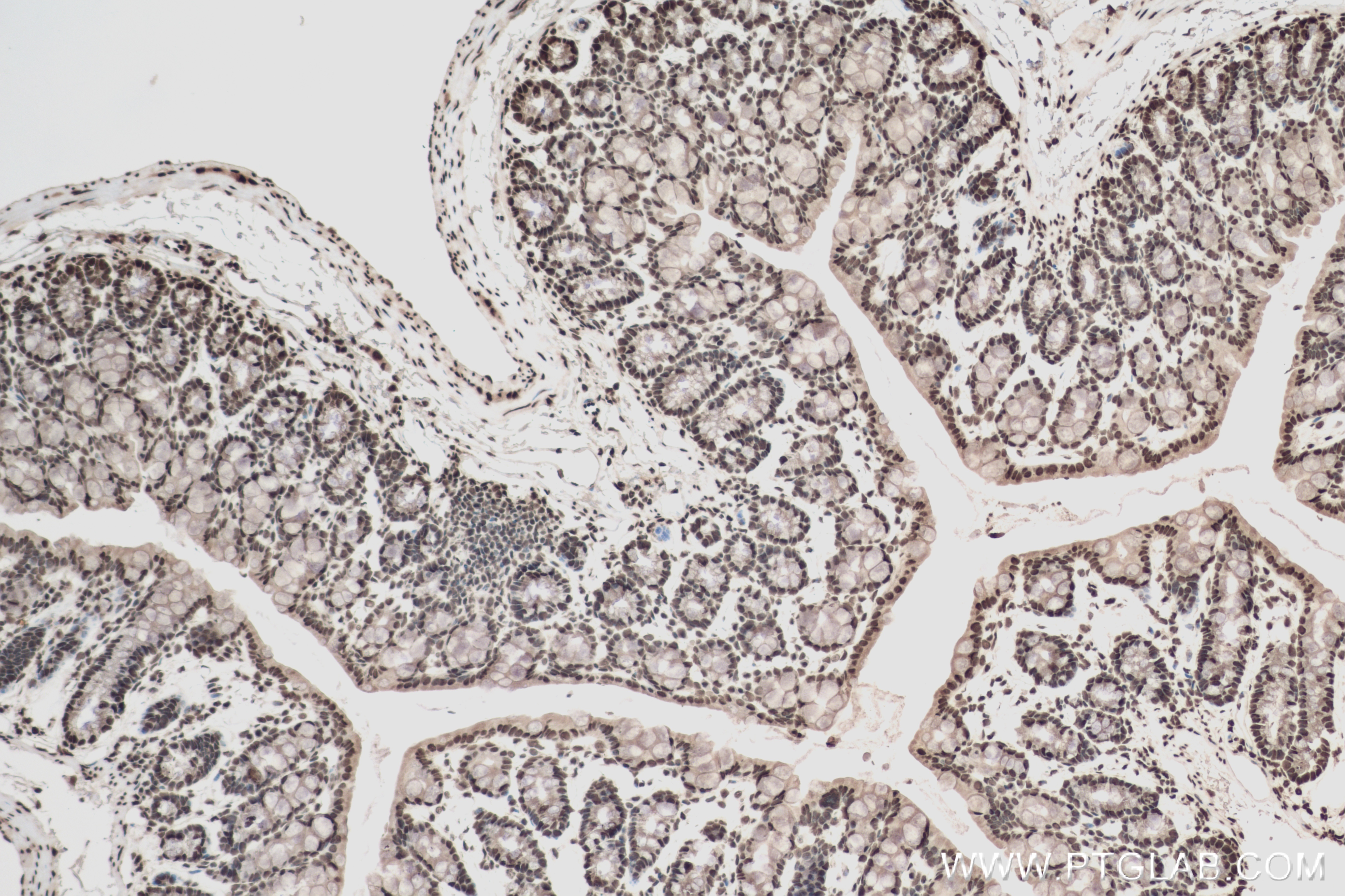 Immunohistochemistry (IHC) staining of mouse colon tissue using HNRNPA2B1 Recombinant antibody (83773-7-RR)