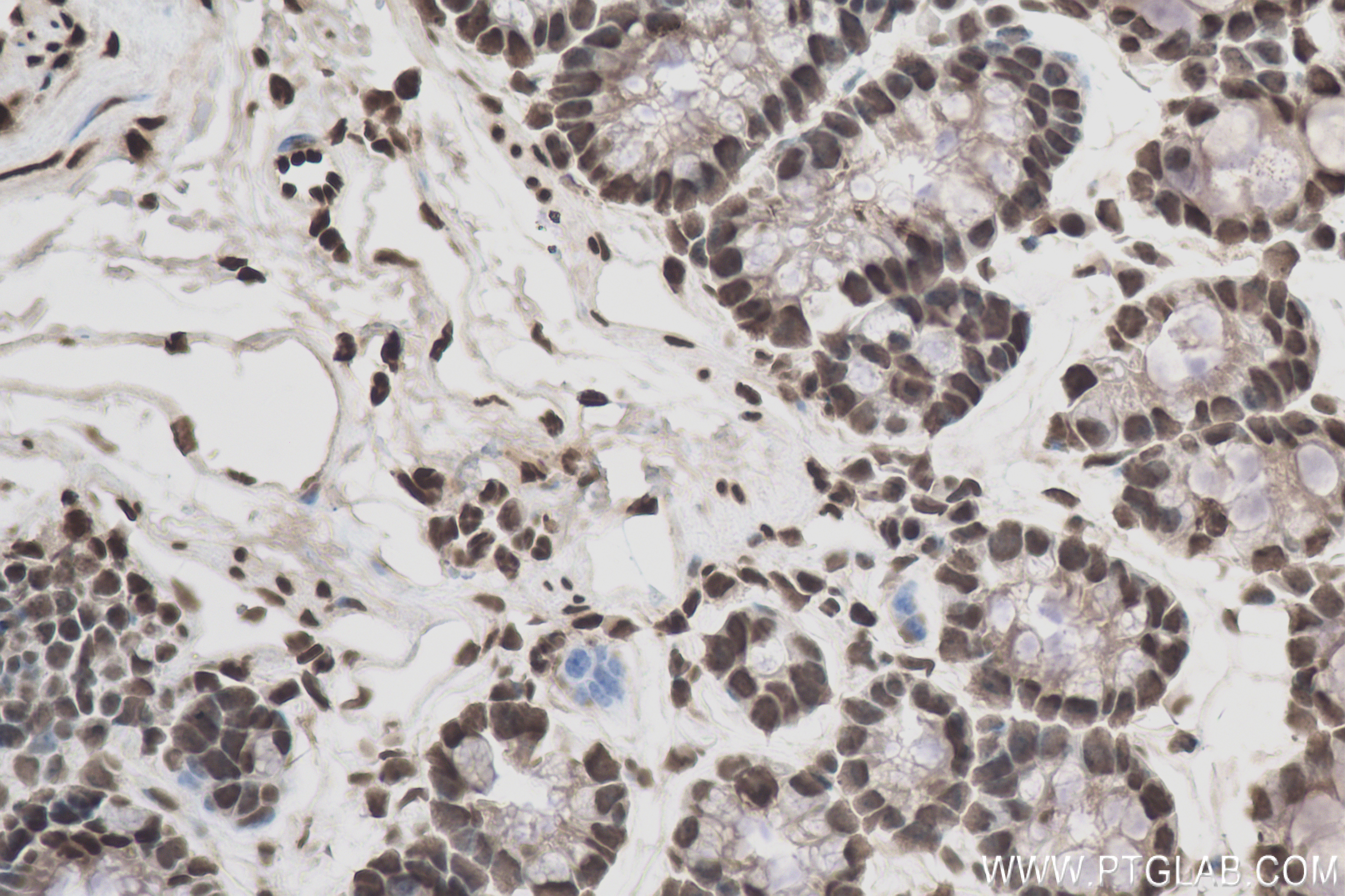 Immunohistochemistry (IHC) staining of mouse colon tissue using HNRNPA2B1 Recombinant antibody (83773-7-RR)