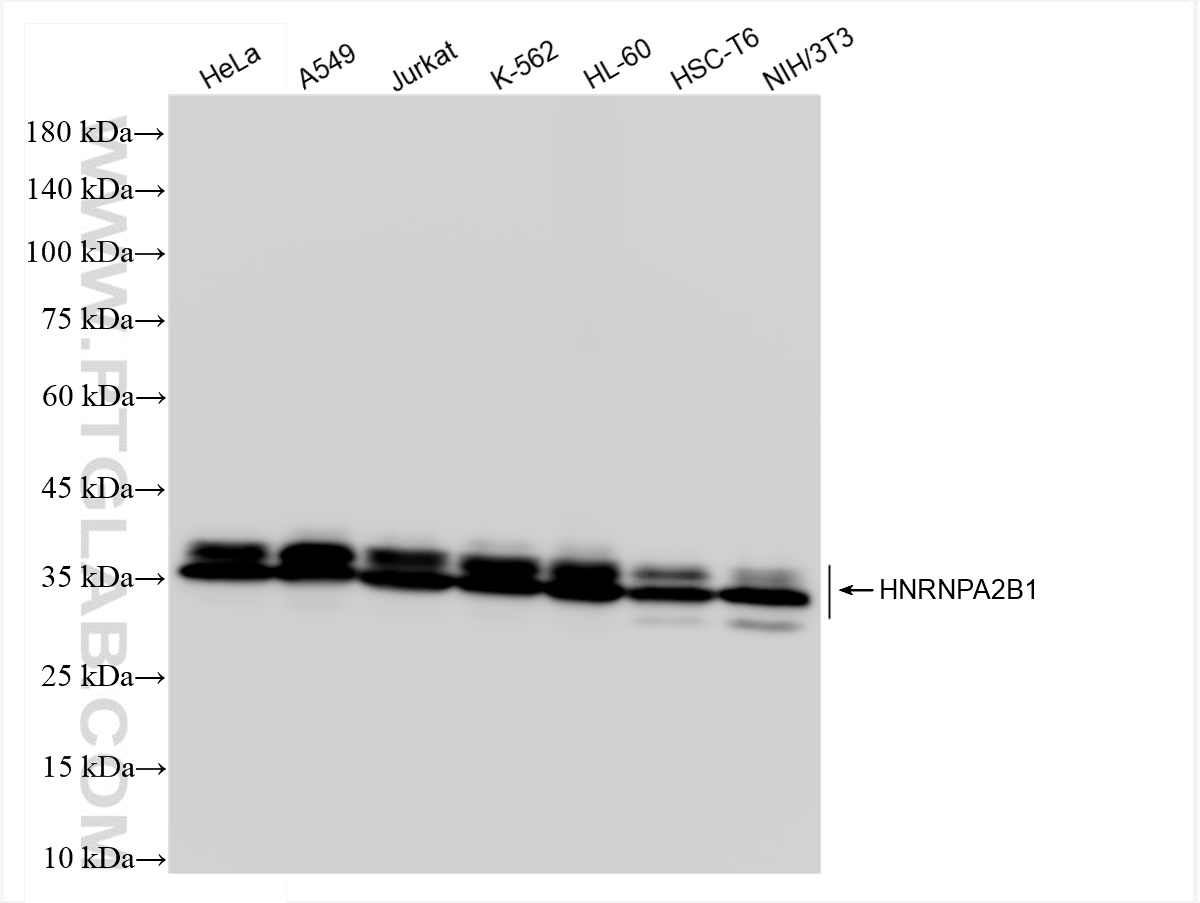 Western Blot (WB) analysis of various lysates using HNRNPA2B1 Recombinant antibody (83773-7-RR)