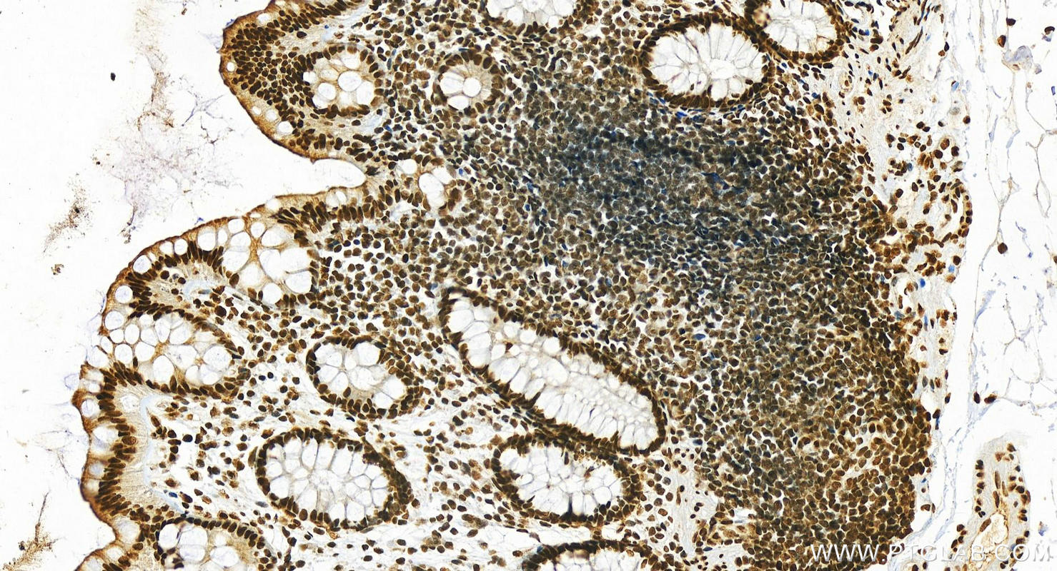 Immunohistochemistry (IHC) staining of human  colon using HNRNPA3 Polyclonal antibody (25142-1-AP)