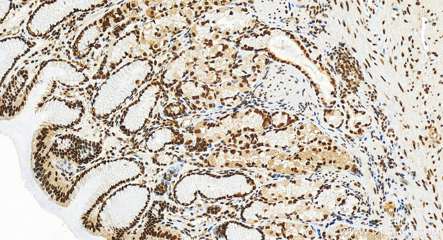 Immunohistochemistry (IHC) staining of human stomach tissue using HNRNPA3 Polyclonal antibody (25142-1-AP)