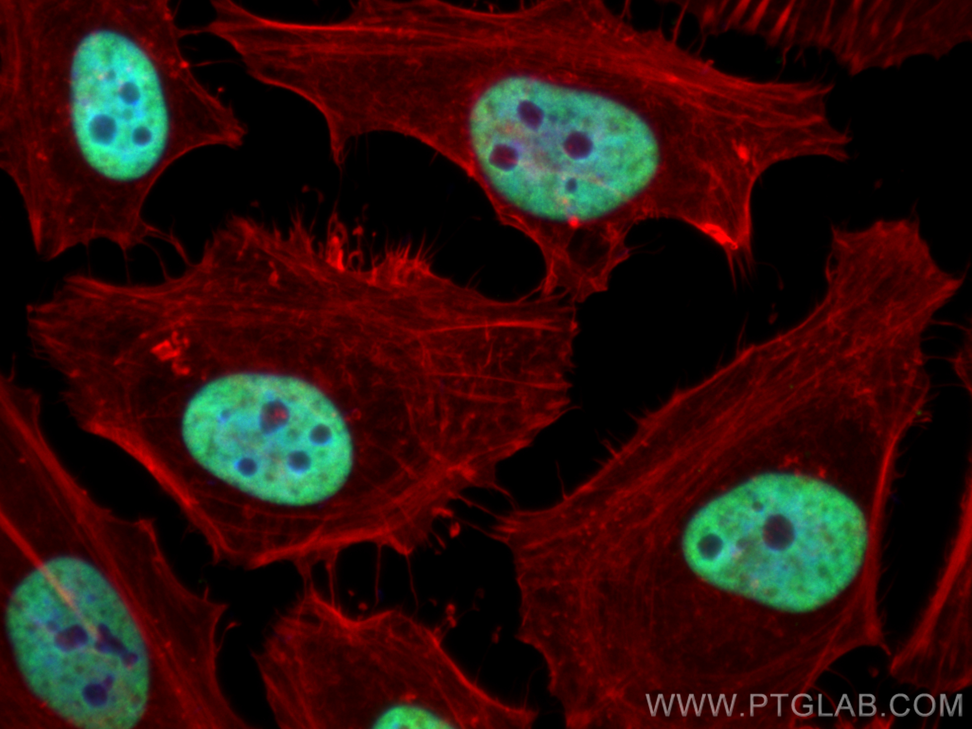 Immunofluorescence (IF) / fluorescent staining of HeLa cells using HNRNPC Polyclonal antibody (11760-1-AP)