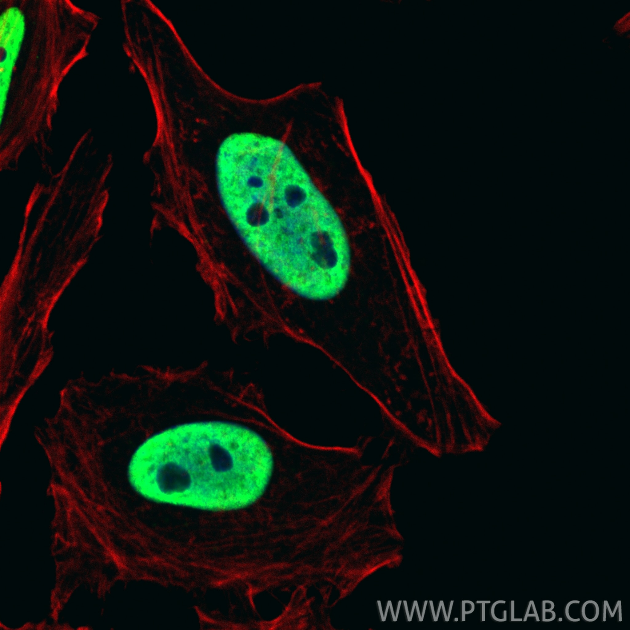 Immunofluorescence (IF) / fluorescent staining of HeLa cells using HNRNPC Polyclonal antibody (11760-1-AP)
