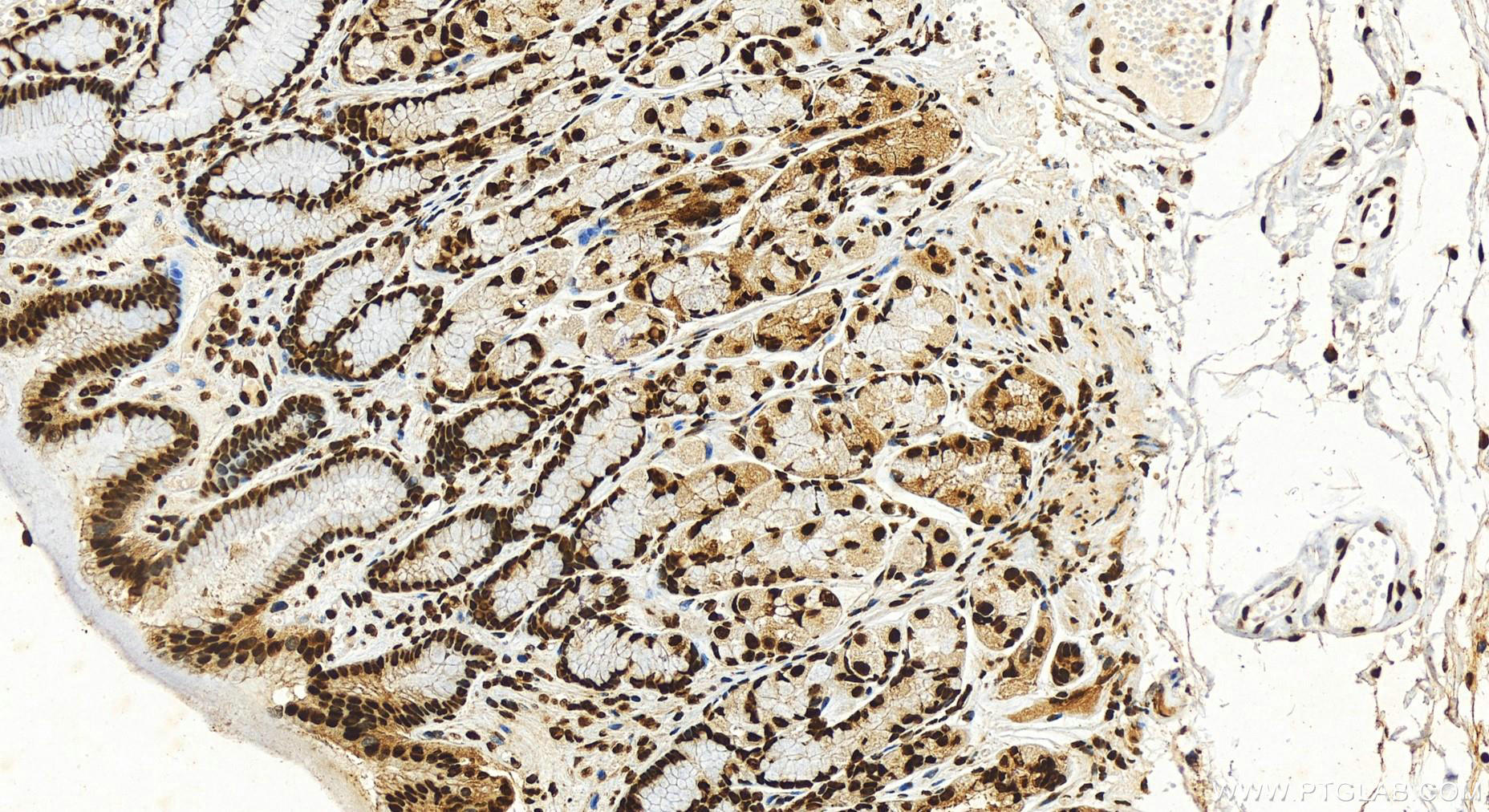 Immunohistochemistry (IHC) staining of human stomach tissue using HNRNPC Recombinant antibody (82798-3-RR)