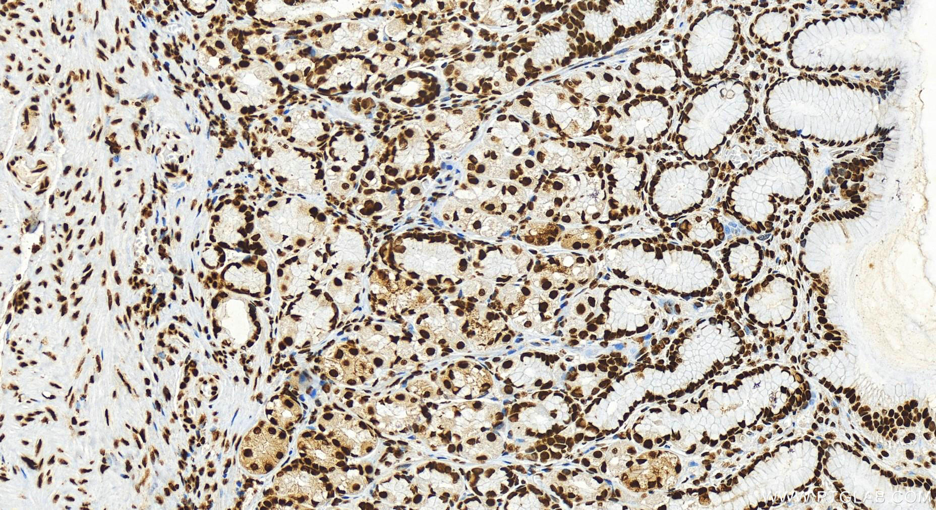 Immunohistochemistry (IHC) staining of human stomach tissue using HNRNPC Recombinant antibody (82798-3-RR)