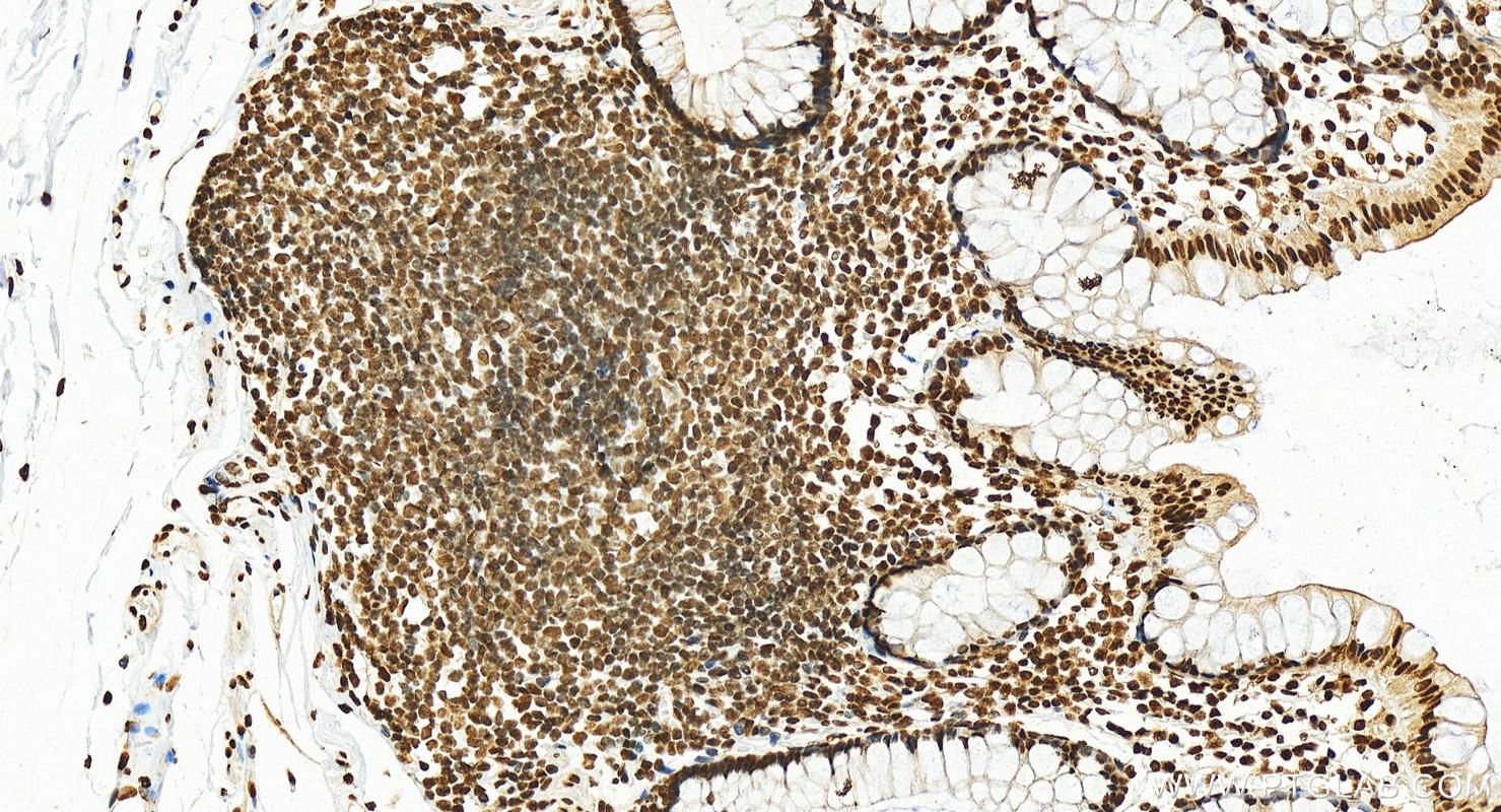 Immunohistochemistry (IHC) staining of human normal colon using HNRNPD Polyclonal antibody (12770-1-AP)