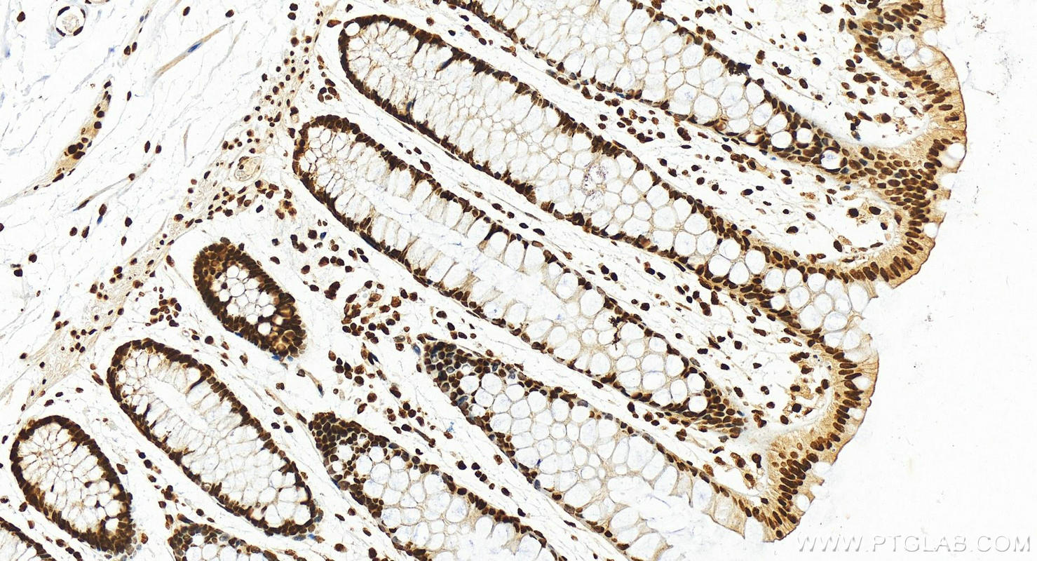 Immunohistochemistry (IHC) staining of human normal colon using HNRNPD Polyclonal antibody (12770-1-AP)