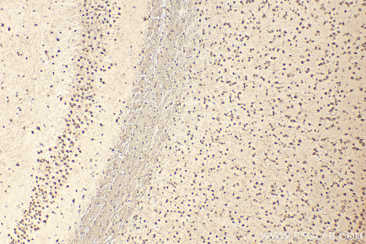 Immunohistochemistry (IHC) staining of mouse brain tissue using HNRNPK Polyclonal antibody (11426-1-AP)