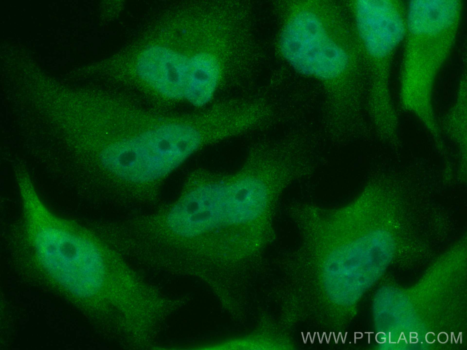 Immunofluorescence (IF) / fluorescent staining of HeLa cells using CoraLite® Plus 488-conjugated HNRNPK Polyclonal an (CL488-11426)