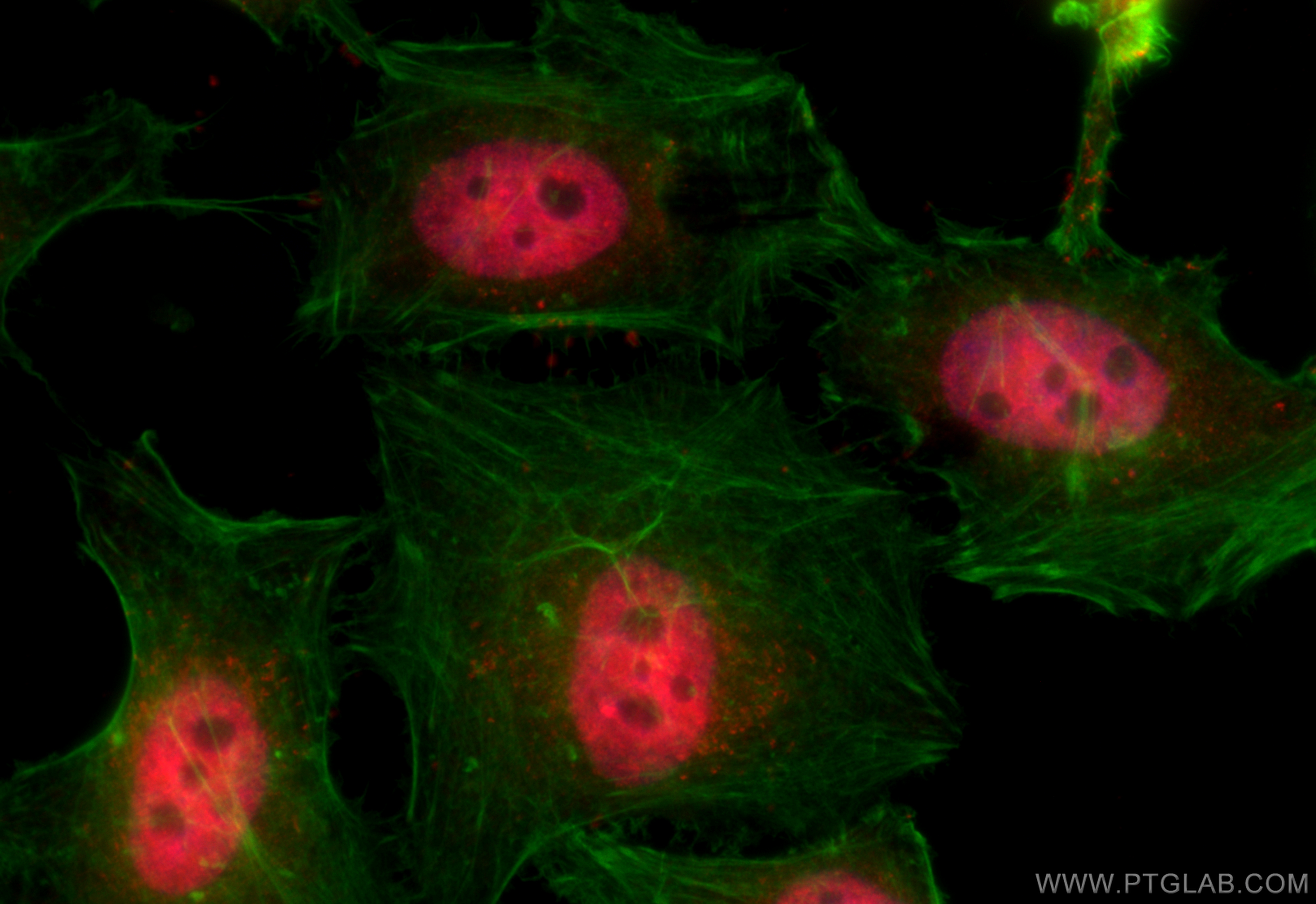 Immunofluorescence (IF) / fluorescent staining of HeLa cells using HNRNPL Polyclonal antibody (18354-1-AP)