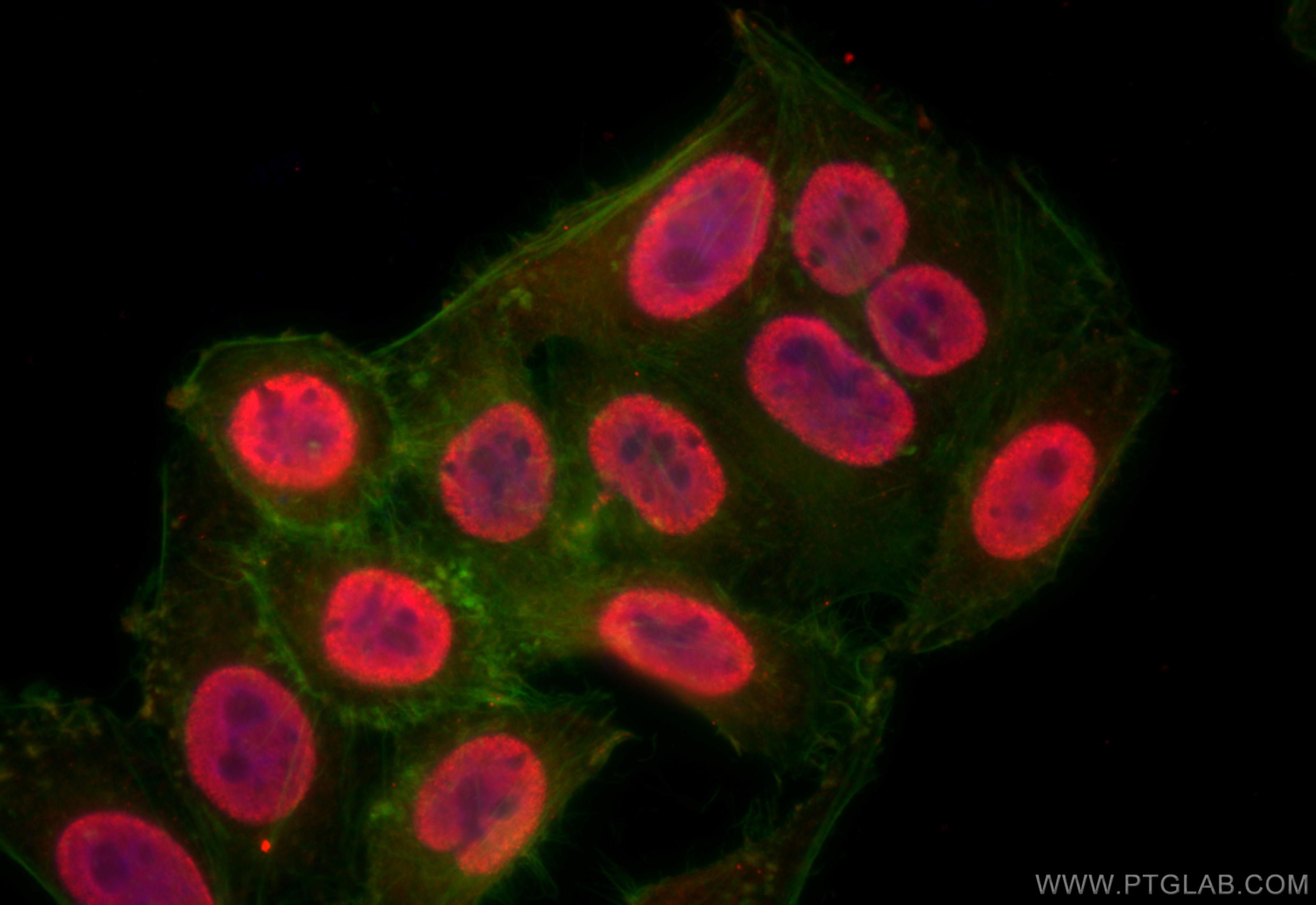 Immunofluorescence (IF) / fluorescent staining of HepG2 cells using HNRNPM Polyclonal antibody (26897-1-AP)