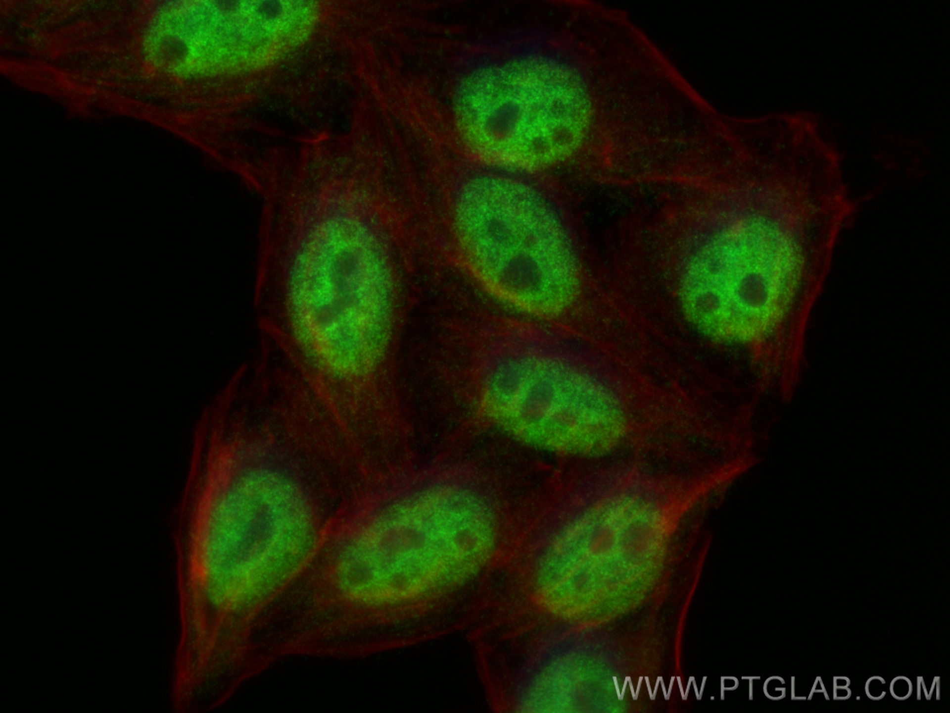Immunofluorescence (IF) / fluorescent staining of HepG2 cells using HNRNPU Polyclonal antibody (16365-1-AP)