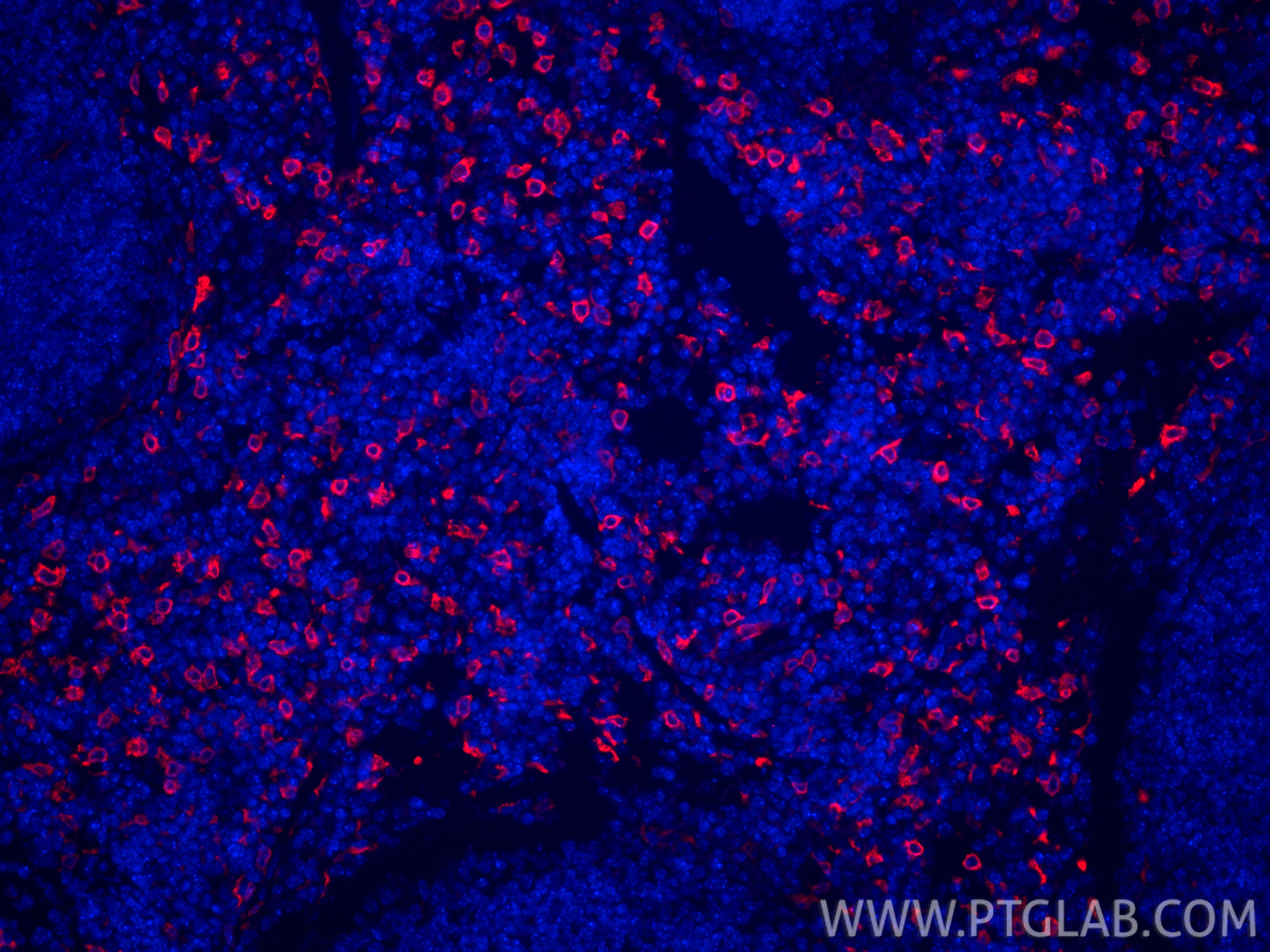 Immunofluorescence (IF) / fluorescent staining of mouse spleen tissue using CoraLite®594-conjugated HO-1/HMOX1 Polyclonal anti (CL594-10701)