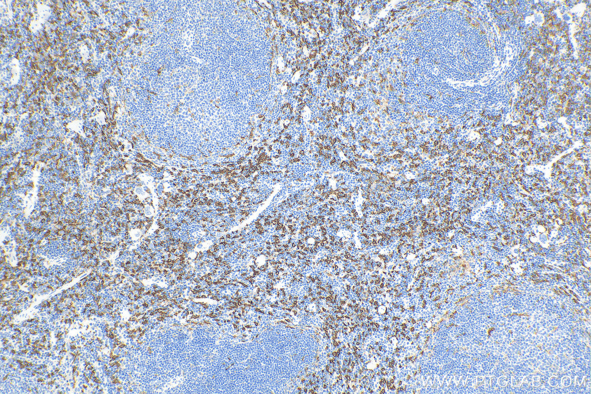 Immunohistochemistry (IHC) staining of mouse spleen tissue using HO-1/Hmox1 Recombinant antibody (83291-3-RR)