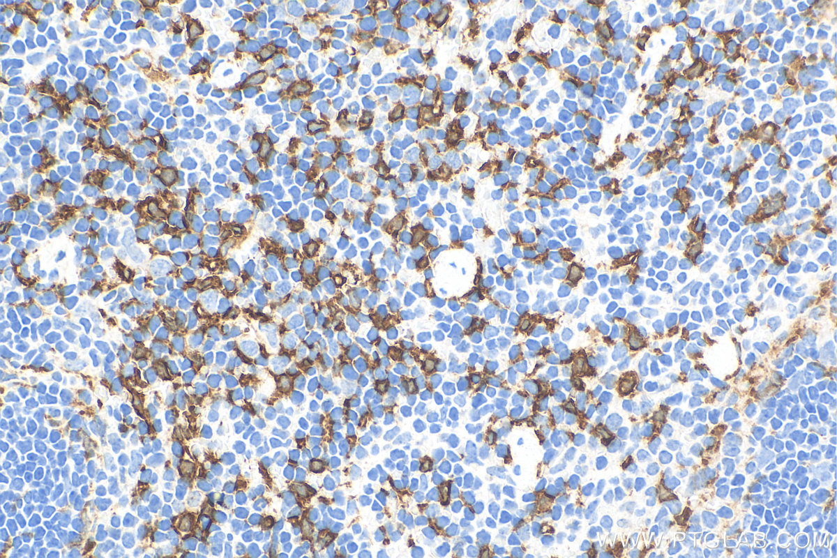 Immunohistochemistry (IHC) staining of mouse spleen tissue using HO-1/Hmox1 Recombinant antibody (83291-3-RR)