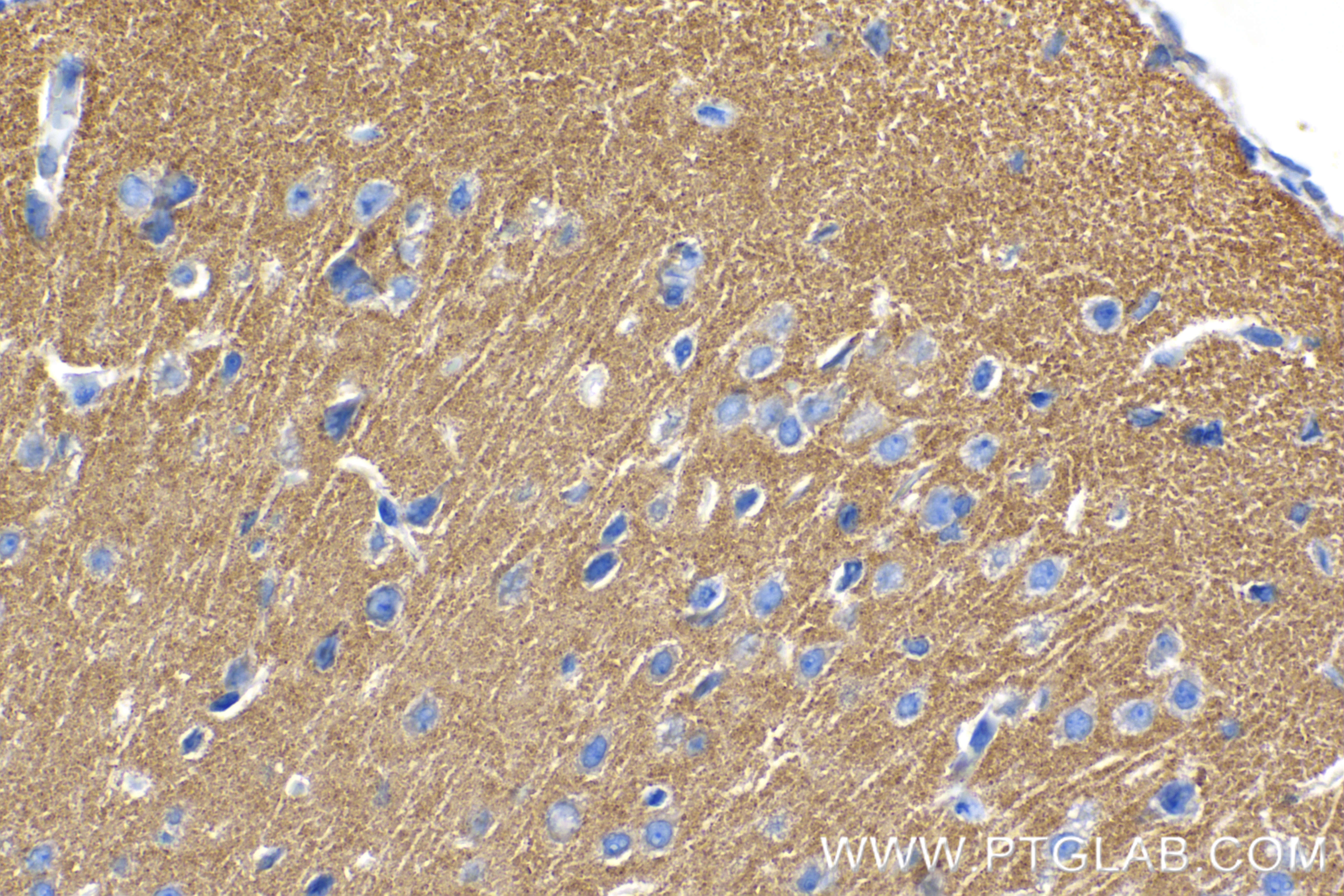 Immunohistochemistry (IHC) staining of mouse brain tissue using HOMER1 Recombinant antibody (85692-4-RR)