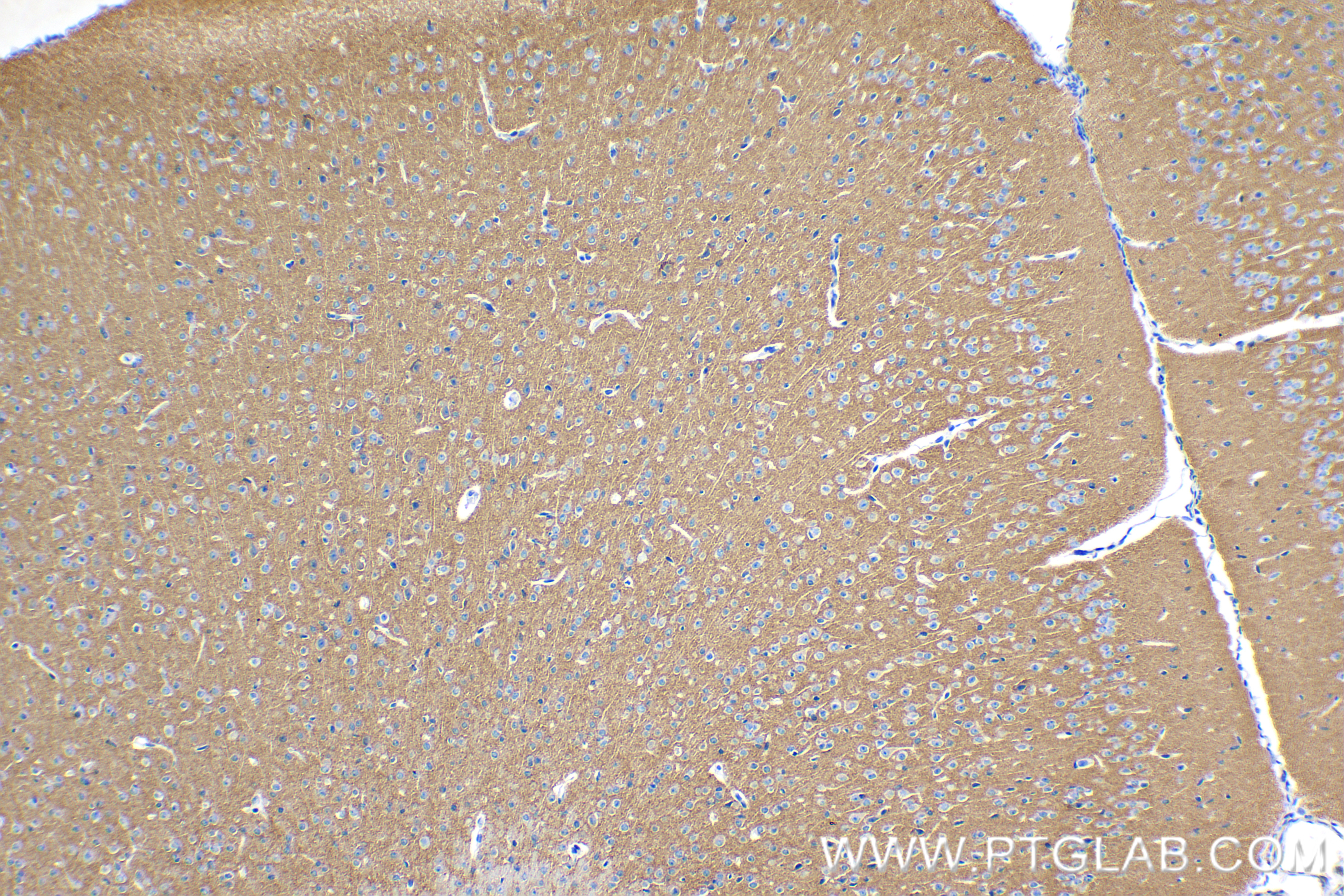 Immunohistochemistry (IHC) staining of mouse brain tissue using HOMER1 Recombinant antibody (85692-4-RR)