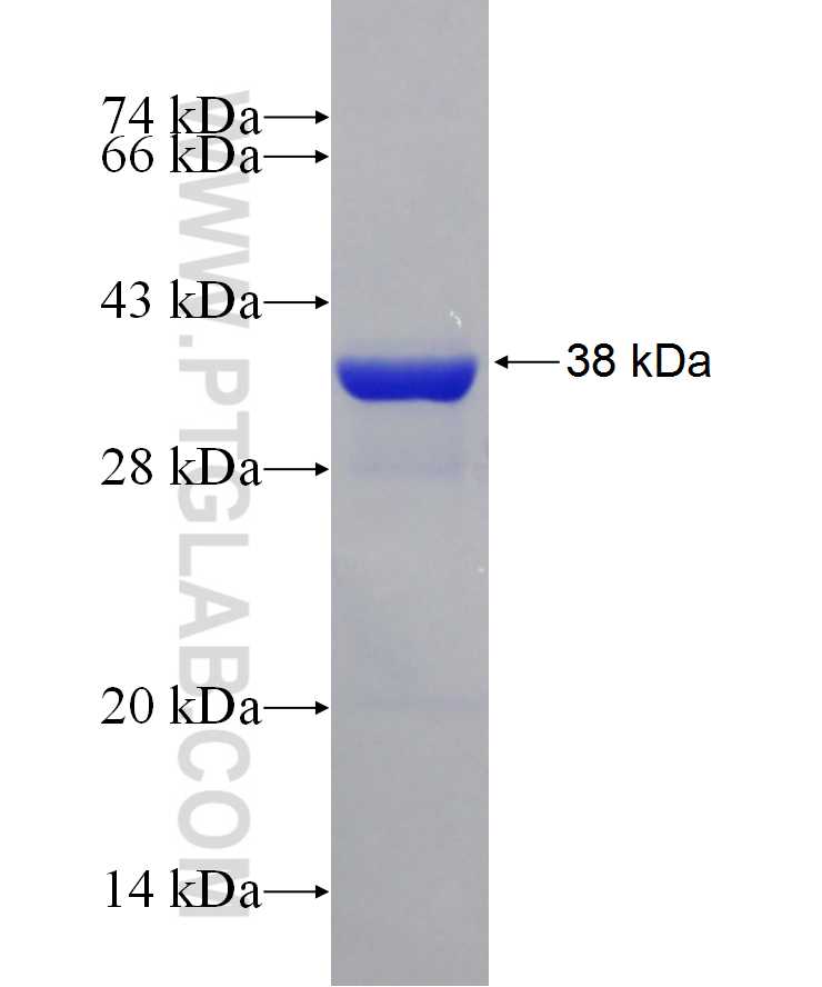 HOMER2 fusion protein Ag29718 SDS-PAGE