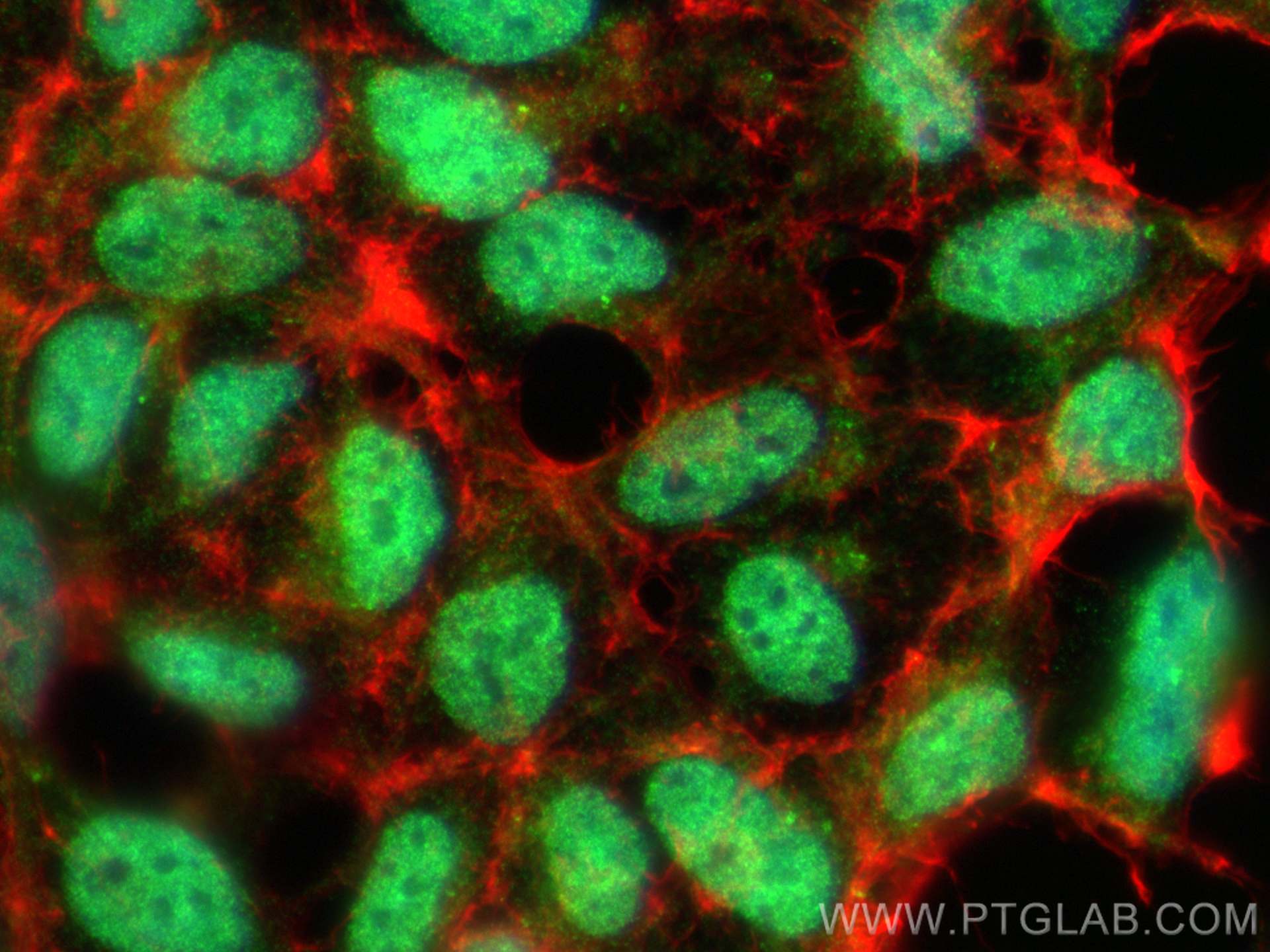 Immunofluorescence (IF) / fluorescent staining of HEK-293 cells using HOMEZ Polyclonal antibody (23965-1-AP)