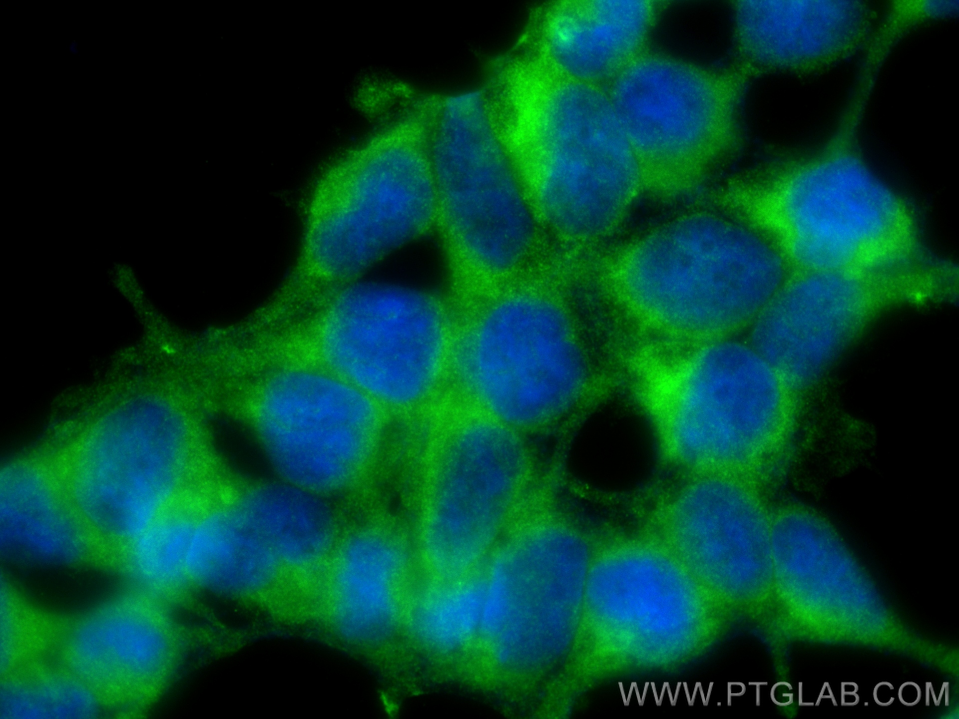 Immunofluorescence (IF) / fluorescent staining of HEK-293 cells using HOOK1 Polyclonal antibody (10871-1-AP)