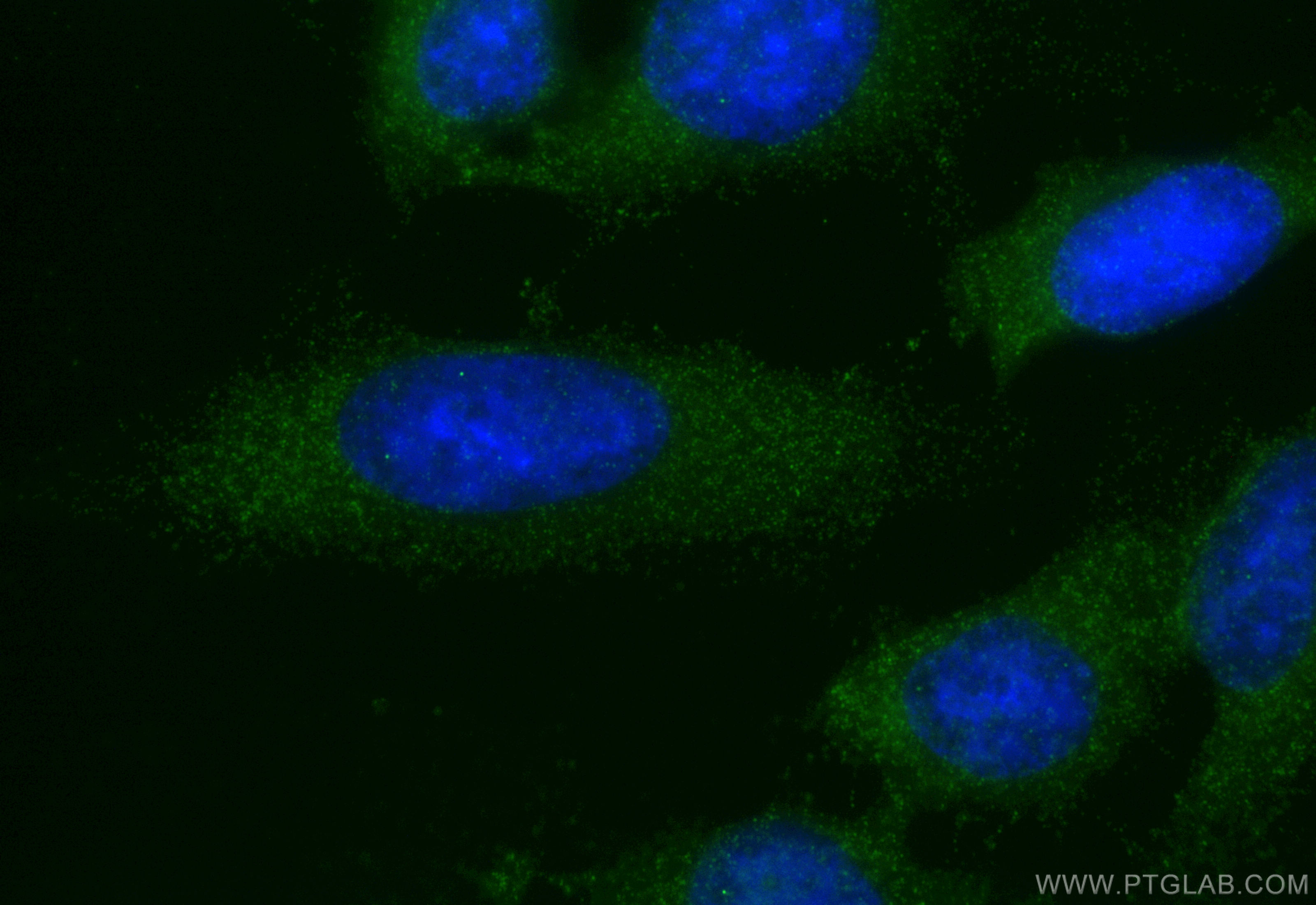 Immunofluorescence (IF) / fluorescent staining of HeLa cells using HOOK2 Polyclonal antibody (12458-1-AP)